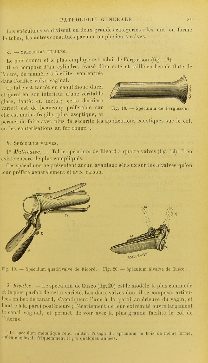 Les spéculums se divisent en deux grandes catégories : les uns en forme de tubes, les autres constitués par une ou plusieurs valves. a. — Spéculums tubulés. Le plus connu et le plus employé est celui de Fergusson (fig. 18). Il se compose d'un cylindre, évasé d'un côté et taillé en bec de flûte de l'autre, de manière à faciliter son entrée dans l'orifice vulvo-vaginal. Ce tube est tantôt en caoutchouc durci et garni en son intérieur d'une véritable glace, tantôt en métal; cette dernière variété est de beaucoup préférable car Fig. 18. — Spéculum de Fergusson. elle est moins fragile, plus aseptique, et permet de faire avec plus de sécurité les applications caustiques sur le col, ou les cautérisations au fer rouge1. b. Spéculums valvés. 1° Mirftivalve. — Tel le spéculum de Ricord à quatre valves (fig. 19) ; il en existe encore de plus compliqués. Ces spéculums ne présentent aucun avantage sérieux sur les bivalves qu'on leur préfère généralement et avec raison. Fig. 19. — Spéculum quadrivalve de Ricord. Fig. 20. — Spéculum bivalve de Cusco. 2° Bivalve. — Le spéculum de Cusco (fig. 20) est le modèle le plus commode et le plus parfait de cette variété. Les deux valves dont il se compose, articu- lées en bec de canard, s'appliquent l'une à la paroi antérieure du vagin, et l'autre à la paroi postérieure ; lïeartement de leur extrémité ouvre largement le canal vaginal, et permet de voir avec la plus grande facilité le col de l'utérus. ' Le spéculum métallique rend inulile l'usage du spéculum en bois de même forme, qu'on employait fréquemment il y a quelques années.