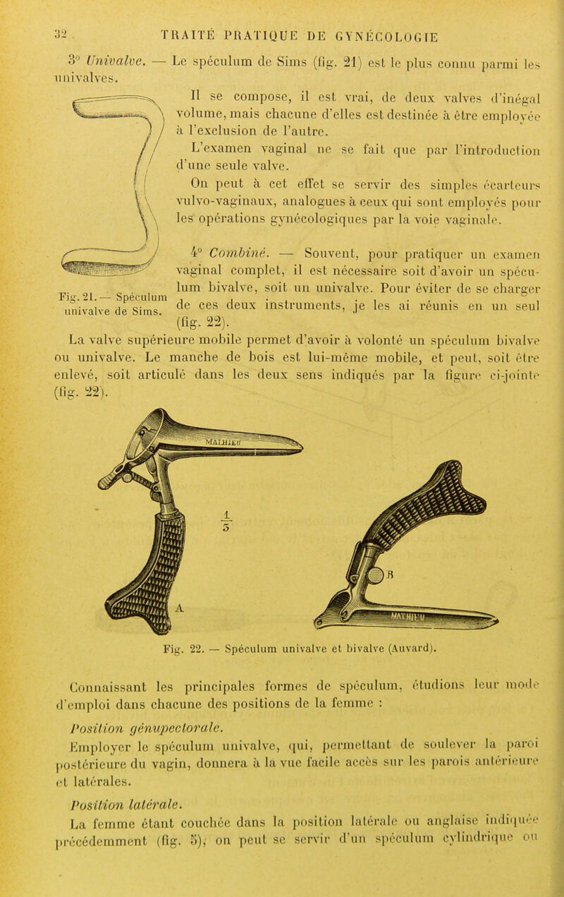 3° Univalve. — Le spéculum de Sims (fig. 21) est le plus connu parmi les uni valve s. Il se compose, il est vrai, de deux valves d'inégal volume, mais chacune d'elles est destinée à être employée à l'exclusion de l'autre. L'examen vaginal ne se fait que par l'introduction d'une seule valve. On peut à cet effet se servir des simples éçarteurs vulvo-vaginaux, analogues à ceux qui sont employés poul- ies opérations gynécologiques par la voie vaginale. 4° Combiné. — Souvent, pour pratiquer un examen vaginal complet, il est nécessaire soit d'avoir un spécu- lum bivalve, soit un univalve. Pour éviter de se charger Fig. 21.— Spéculum , . . ..... , univalve de Sims ces instruments, je les ai reunis en un seul  (fig. 22). La valve supérieure mobile permet d'avoir à volonté un spéculum bivalve ou univalve. Le manche de bois est lui-même mobile, et peut, soit être enlevé, soit articulé dans les deux sens indiqués par la figure ci-jointe (fig. SB). Fig. 22. — Spéculum univalve et bivalve (Auvard). Connaissant les principales formes de spéculum, étudions leur mode d'emploi dans chacune des positions de la femme : Position gènupccloralc. Employer le spéculum univalve, qui, permettant de soulever la paroi postérieure du vagin, donnera à la vue facile accès sur les parois antérieure et latérales. Position latérale. La femme étant couchée dans la position latérale ou anglaise indiquée précédemment (fig. 5), on peut se servir d'un spéculum cylindrique ou