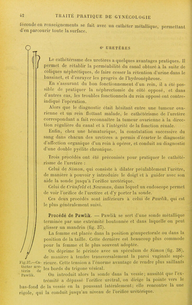 féconde en renseignements se fait avec un cathéter métallique, permettant d'en parcourir toute la surface. o 6° URETÈRES Le cathéténsme des uretères a quelques avantages pratiques. Il permet de rétablir la perméabilité du canal obturé à la suite de coliques néphrétiques, de faire cesser la rétention d'urine dans le bassinet, et d'enrayer les progrès de l'hydronéphrose. En s'assurant du bon fonctionnement d'un rein, il a été pos- sible de pratiquer la néphrectomie du côté opposé, et dans d'autres cas, les troubles fonctionnels du rein opposé ont contre- indiqué l'opération. Alors que le diagnostic était hésitant entre une tumeur ova- rienne et un rein flottant malade, le cathétérisme de l'uretère correspondant a fait reconnaître la tumeur ovarienne à la direc- tion régulière du canal et à l'intégrité de la fonction rénale. Enfin, chez une hématurique, la constatation successive du sang dans chacun des uretères a permis d'écarter le diagnostic d'affection organique d'un rein à opérer, et conduit au diagnostic d'une double pyélite chronique. Trois procédés ont été préconisés pour pratiquer le cathété- risme de l'uretère : Celui de Simon, qui consiste à dilater préalablement l'urètre, de manière à pouvoir y introduire le doigt et à guider avec son aide la sonde jusqu'à l'orifice uretérique. Celui de Crùnfeldel Neioman, dans lequel un endoscope permet de voir l'orifice de l'uretère et d'y porter la sonde. Ces deux procédés sont inférieurs à celui de Paiolik, qui est le plus généralement suivi. Procédé de Pawlik. — Pawlik se sert d'une sonde métallique terminée par une extrémité boutonnée et dans laquelle on peut glisser un mandrin (fig. 37). La femme est placée dans la position génupectorale ou dans la position de la taille. Cette dernière est beaucoup plus commode pour la femme et le plus souvent adoptée. On déprime le périnée avec un spéculum de Simon (fig. 38), de manière à tendre transversalement la paroi vaginale supé- Fig.37.—Ga- rieurc. Cette Lcnsion a l'énorme avantage de rendre plus saillants théier ure- } fa , du t j vésical. icrin de Pawlik. On introduit alors la sonde dans la vessie; aussitôt que l'ex- trémité a dépassé l'orifice ûrétral, on dirige la pointe vers le bas-fond de la vessie en la poussant latéralement; elle rencontre là une rigole, qui la conduit jusqu'au niveau de l'orifice urétérique.