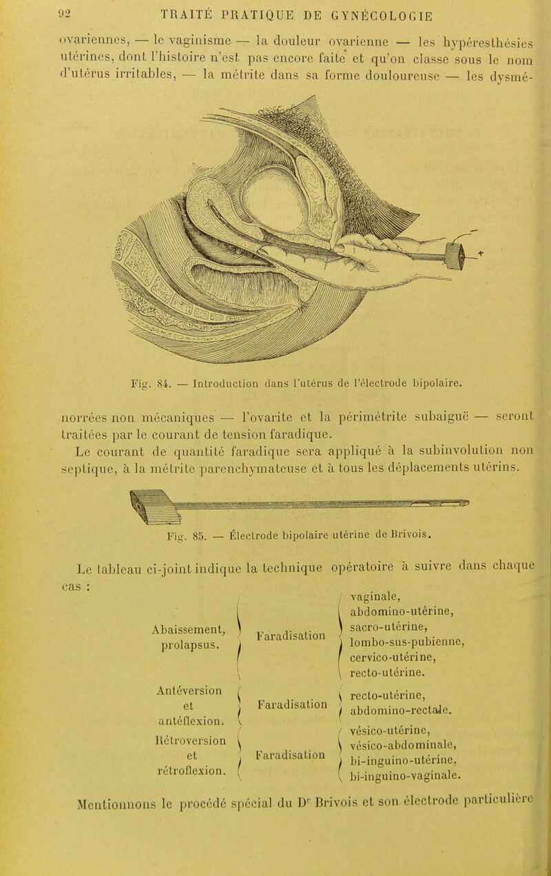 ovariennes, — le vaginisme — la douleur ovarienne — les aypéresthésies utérines, dont l'histoire n'est pas encore faite et qu'on classe sous le nom d'utérus irritables, — la métrite dans sa forme douloureuse — les dysmé- Fig. 84. — Introduction dans l'utérus de l'électrode bipolaire. norrées non mécaniques — l'ovarite et la périmétrite subaiguë — seront traitées par le courant de tension faradique. Le courant de quantité faradique sera appliqué à la subinvolution non septique, à la métrite parenchymateuse et à tous les déplacements utérins. Fig. 85. — Électrode bipolaire utérine de Brivois. Le tableau ci-joint indique la technique opératoire à suivre dans chaque cas Abaissement, prolapsus. Antéversion ( et i a ntéllexion. v Rétroversion \ et Faradisation Faradisation Faradisation vaginale, I abdomiuo-utérine, \ sacro-utérine, 1 lombo-sus-pubienne, [ cervico-utérine, \ recto-utérine. \ recto-utérine, I abdomino-rectaJe. / vésico-utérine, \ vésico-abdominale, bi-inguino-utérine. ;uino-vaginale. /  / bi-ingui rotroflcxion. f f hi.inguir Mentionnons le procédé spécial du D'' Brivois et son électrode particulier^