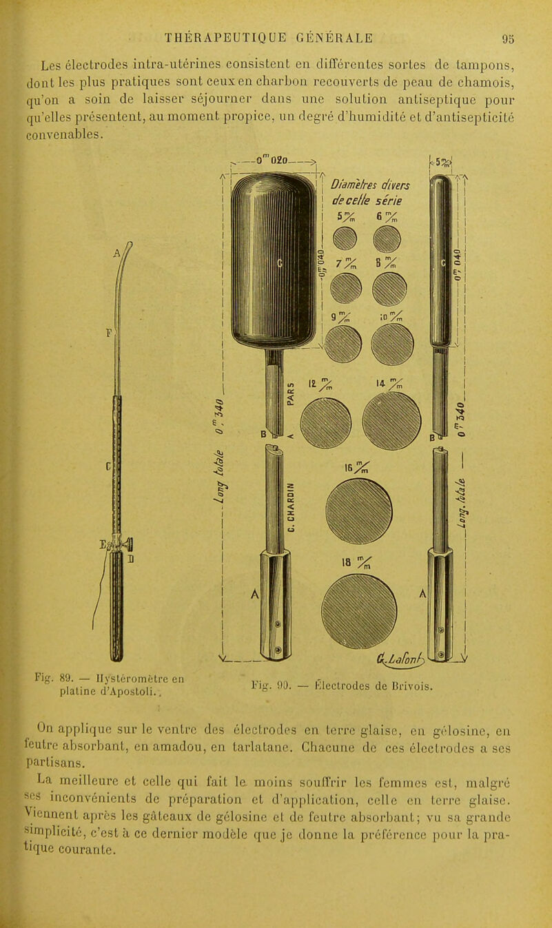 Les électrodes intra-utérines consistent en différentes sortes de tampons, dont les plus pratiques sont ceux en charbon recouverts de peau de chamois, qu'on a soin de laisser séjourner dans une solution antiseptique pour qu'elles présentent, au moment propice, un degré d'humidité et d'antisepticité convenables. Fig. On applique sur le ventre des électrodes en terre glaise, en gélosine, en feutre absorbant, en amadou, en tarlatane. Chacune de ces électrodes a ses partisans. La meilleure et celle qui fait le. moins souffrir les femmes est, malgré ses inconvénients de préparation et d'application, celle en terre glaise, viennent après les gâteaux de gélosine cl de feutre absorbant; vu sa grande simplicité, c'est à ce dernier modèle que je donne la préférence pour la pra- tique courante.