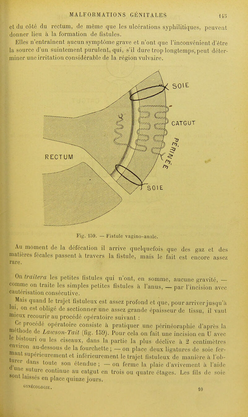 et du côté du rectum, de même que les ulcérations syphilitiques, peuvent donner lieu à la formation de Qstules. Elles n'entraînent aucun symptôme grave et n'ont que l'inconvénient d'être la source d'un suintement purulent, qui, s'il dure trop longtemps, peut déter- miner une irritation considérable de la région vulvaire. SOIE- CATGUT Fig. 159. — Fistule vagino-anale. Au moment de la défécation il arrive quelquefois que des gaz et des matières fécales passent à travers la fistule, mais le fait est encore assez rare. On traitera les petites fistules qui n'ont, en somme, aucune gravité, — comme on traite les simples petites fistules à l'anus, — par l'incision avec cautérisation consécutive. Mais quand le trajet fistuleux est assez profond et que, pour arriver jusqu'à bu, on est obligé de sectionner une assez grande épaisseur de tissu, il vaut mieux recourir au procédé opératoire suivant : Ce procédé opératoire consiste à pratiquer uae périnéoraphie d'après la méthode de Lawson-Tait (fig. 159). Pour cela on fait une incision en U avec P bistouri ou les ciseaux, dans la partie la plus déclive à 2 centimètres ^viron au-dessous de la fourchette ; — on place deux ligaturés de soie fer- t ant suPéeurement et intérieurement le trajet fistuleux de manière à l'ob- urer ,l;'s toute son étendue; — on ferme la plaie d'avivement à l'aide une suture continue au catgut en trois ou quatre étages. Les fils de soie sont laissés eu place quinze jours. GYNÉCOLOGIE. j/j