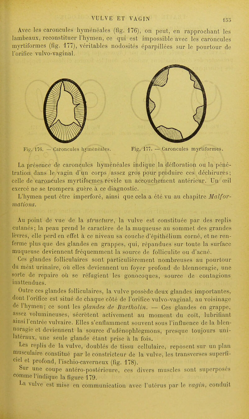 Avec les caroncules hyménéales (fig. 176), on peut, en rapprochant les lambeaux, reconstituer l'hymen, ce qui est impossible avec les caroncules myrtiformes (fig. 177), véritables nodosités éparpillées sur le pourtour de l'orifice vulvo-vaginal. Fig. 176. — Caroncules hyménéales. Fig. 177. — Caroncules myrtiformes. La présence de caroncules hyménéales indique la défloration ou la péné- tration dans le vagin d'un corps assez gros pour produire ces déchirures ; celle de caroncules myrtiformes révèle un accouchement antérieur. Un œil exercé ne se trompera guère à ce diagnostic. L'hymen peut être imperforé, ainsi que cela a été vu au chapitre Malfor- mations. Au point de vue de la structure, la vulve est constituée par des replis cutanés; la peau prend le caractère de la muqueuse au sommet des grandes lèvres, elle perd en effet à ce niveau sa couche d'épithélium corné, et ne ren- ferme plus que des glandes en grappes, qui, répandues sur toute la surface muqueuse deviennent fréquemment la source de folliculite ou d'acné. Ces glandes folliculaires sont particulièrement nombreuses au pourtour du méat urinaire, où elles deviennent un foyer profond de blennoragie, une sorte de repaire où se réfugient les gonocoques, source de contagions inattendues. Outre ces glandes folliculaires, la vulve possède deux glandes importantes, dont l'orifice est situé de chaque côté de l'orifice vulvo-vaginal, au voisinage de 1 hymen; ce sont les glandes de Bartholin. — Ces glandes en grappe, assez volumineuses, sécrètent activement au moment du coït, lubrifiant ainsi l'entrée vulvaire. Elles s'enflamment souvent sous l'influence de la blen- noragie et deviennent la source d'adénophlegmons, presque toujours uni- l'atéraux, une seule glande étant prise à la fois. Les replis de la vulve, doublés de tissu cellulaire, reposent sur un plan musculaire constitué par le constricteur de la vulve, les transverses superfi- ciel et profond, l'ischio-caverneux (fig. 178). Sur une coupe antéro-postéricure, ces divers muscles sont superposés comme l'indique la figure 179. La vulve est mise en communication avec l'utérus par le vagin, conduit