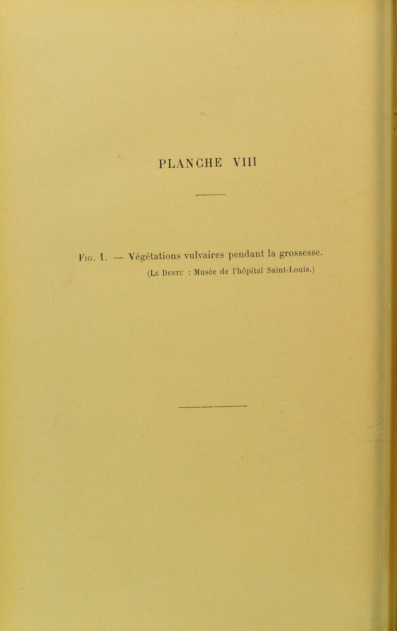 pIG. 1. _ Végétations vulvaires pendant la grossesse. (Le Dentu : Musée de l'hôpital Saint-Louis.)