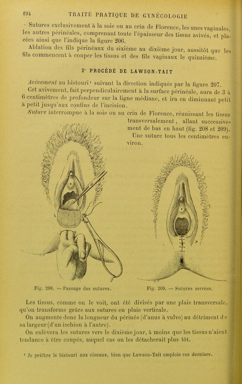• Sutures exclusivement à la soie ou au crin de Florence, les unes vaginales les autres périnéales, comprenant toute l'épaisseur des tissus avivés, et pla- cées ainsi que l'indique la figure 206. Ablation des fils périnéaux du sixième au dixième jour, aussitôt que les fils commencent à couper les tissus et des fils vaginaux le quinzième. 2 PROCÉDÉ DE LAWSON-TAIT Avivement au bistouri1 suivant la direction indiquée par la figure 207. Cet avivement, fait perpendiculairement à la surface périnéale, aura de 3 à 6 centimètres de profondeur sur la ligne médiane, et ira en diminuant petit à petit jusqu'aux confins de l'incision. Suture interrompue à la soie ou au crin de Florence, réunissant les tissus transversalement, allant successive- ment de bas en haut (fïg. 208 et 209). Une suture tous les centimètres en- viron. Fig. 208. — Passage des sutures. Fi#. 209. — Sutures serrées. Les tissus, comme on le voit, ont été divisés par une plaie transversale, qu'on transforme grâce aux sutures en plaie verticale. On augmente donc la longueur du périnée (d'anus à vulve) au détriment d e sa largeur (d'un iscbion à l'autre). On enlèvera les sutures vers le dixième jour, à moins que les tissus n'aient tendance à être coupés, auquel cas on les détacherait plus tôt. 1 Je préfère le bistouri aux ciseaux, bien que Lawson-Tait emploie ces derniers.