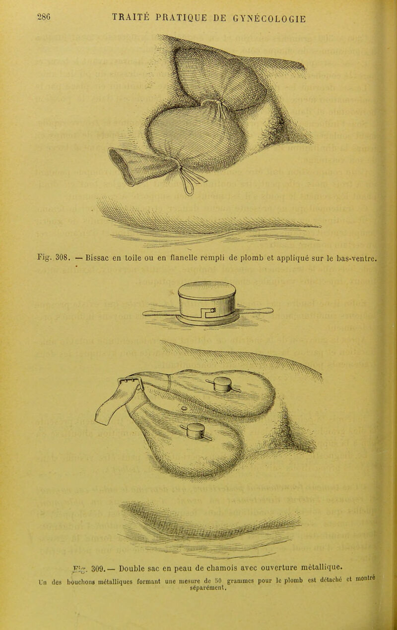 Fig\ 308. — Bissac en toile ou en flanelle rempli de plomb et appliqué sur le bas-venlre. t' 309.— Double sac en peau de chamois avec ouverture métallique. Un des bouclions métalliques formant une mesure de 50 grammes pour le plomb est détaché et montré séparément.