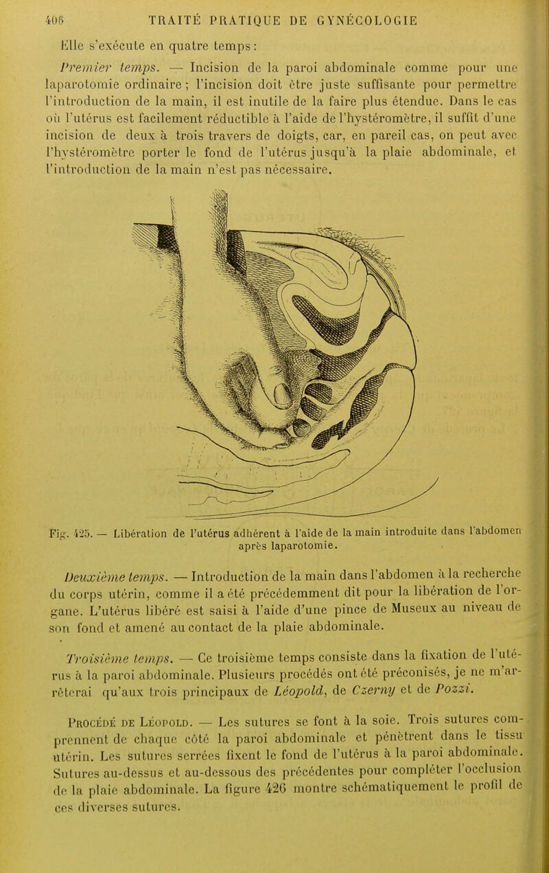 Elle s'exécute en quatre temps: Premier temps. — Incision de la paroi abdominale comme pour une laparotomie ordinaire; l'incision doit être juste suffisante pour permettre l'introduction de la main, il est inutile de la faire plus étendue. Dans le cas où l'utérus est facilement réductible à l'aide de l'hystéromètre, il suffit d'une incision de deux à trois travers de doigts, car, en pareil cas, on peut avec l'hystéromètre porter le fond de l'utérus jusqu'à la plaie abdominale, et l'introduction de la main n'est pas nécessaire. Fig. 425. — Libération de l'utérus adhérent à l'aide de la main introduite dans l'abdomen après laparotomie. Deuxième temps. — Introduction de la main dans l'abdomen à la recherche du corps utérin, comme il a été précédemment dit pour la libération de l'or- gane. L'utérus libéré est saisi à l'aide d'une pince de Museux au niveau de son fond et amené au contact de la plaie abdominale. Troisième temps. — Ce troisième temps consiste dans la fixation de l'uté- rus à la paroi abdominale. Plusieurs procédés ont été préconisés, je ne m'ar- rêterai qu'aux trois principaux de Léopold, de Czerny et de Pozzi. Procédé de Léopold. — Les sutures se font à la soie. Trois sutures com- prennent de chaque côté la paroi abdominale et pénètrent dans le tissu Utérin. Les sutures serrées fixent le fond de l'utérus à la paroi abdominale. Sutures au-dessus et au-dessous des précédentes pour compléter l'occlusion de la plaie abdominale. La ligure 4U2(> montre schématiquement le profil de ces diverses sutures.