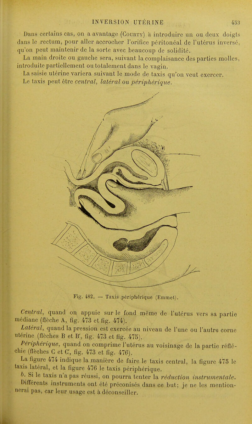 Dans certains cas, on a avantage (Courty) à introduire un ou deux doigts dans le rectum, pour aller accrocher l'orifice péritonéal de l'utérus inversé, qu'on peut maintenir de la sorte avec beaucoup de solidité. La main droite ou gauche sera, suivant la complaisance des parties molles, introduite partiellement ou totalement dans le vagin. La saisie utérine variera suivant le mode de taxis qu'on veut exercer. Le taxis peut être central, latéral ou périphérique. Fig. 482. — Taxis périphérique (Emmet). Central, quand on appuie sur le fond même de l'utérus vers sa partie médiane (flèche A, fig. 473 et fig. 474). Latéral, quand la pression est exercée au niveau de l'une ou l'autre corne utérine (flèches B et B', fig. 473 et fig. 475). Périphérique, quand on comprime l'utérus au voisinage de la partie réflé- chie (flèches G et C, fig. 473 et fig. 476). La figure 474 indique la manière de faire le taxis central, la figure 475 le taxis latéral, et la figure 476 le taxis périphérique. b. Si le taxis n'a pas réussi, on pourra tenter la réduction instrumentale. Différents instruments ont été préconisés dans ce but; je ne les mention- nerai pas, car leur usage est à déconseiller.