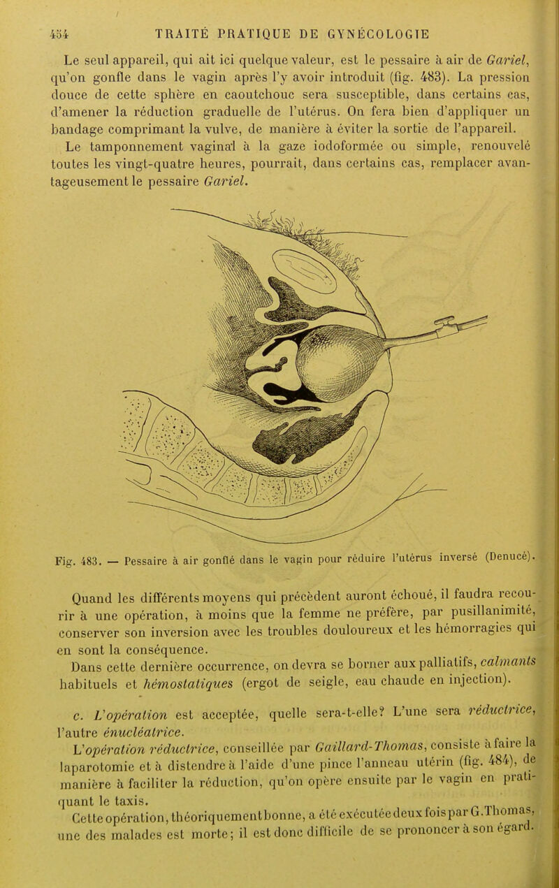 Le seul appareil, qui ait ici quelque valeur, est le pessaire à air de Gariel, qu'on gonfle dans le vagin après l'y avoir introduit (fïg. 483). La pression douce de cette sphère en caoutchouc sera susceptible, dans certains cas, d'amener la réduction graduelle de l'utérus. On fera bien d'appliquer un bandage comprimant la vulve, de manière à éviter la sortie de l'appareil. Le tamponnement vaginai à la gaze iodoformée ou simple, renouvelé toutes les vingt-quatre heures, pourrait, dans certains cas, remplacer avan- tageusement le pessaire Gariel. Fig. 483. — Pessaire à air gonflé dans le vaf,'in pour réduire l'utérus inversé (Denucè). Quand les différents moyens qui précèdent auront échoué, il faudra recou- rir à une opération, à moins que la femme ne préfère, par pusillanimité, conserver son inversion avec les troubles douloureux et les hémorragies qui en sont la conséquence. Dans cette dernière occurrence, on devra se borner aux palliatifs, calmants habituels et hémostatiques (ergot de seigle, eau chaude en injection). c. Vopération est acceptée, quelle sera-t-elle? L'une sera réductrice, l'autre énucléalrice. Vopération réductrice, conseillée par Gaillard-Thomas, consiste à faire la laparotomie et à distendre à l'aide d'une pince l'anneau utérin (fig. 484), de manière à faciliter la réduction, qu'on opère ensuite par le vagin en prati- quant le taxis. Cetteopération,théoriquementbonnc,a«Mr<xr(HilredeuxfoisparG.Tbonias. une des malades est morte; il est donc difficile de se prononcer à son égard.