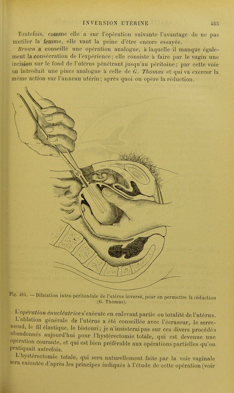 Toutefois, comme elle a sur l'opération suivante l'avantage de ne pas mutiler la femme, elle vaut la peine d'être encore essayée. Brown a conseillé une opération analogue, à laquelle il manque égale- ment la consécration de l'expérience; elle consiste à faire par le vagin une incision sur le fond de l'utérus pénétrant jusqu'au péritoine; par cette voie on introduit une pince analogue à celle de G. Thomas et qui va exercer la même action sur l'anneau utérin; après quoi on opère la réduction. Fig. m. — Dilatation intra-péritonéale de l'utérus inversé, pour en permettre la réductiou (G. Thomas). L'opération énucléatrice s'exécute en enlevant partie ou totalité de l'utérus. L'ablation générale de l'utérus a été conseillée avec l'écraseur, le serre- nœud, le fil élastique, le bistouri; je n'insisterai pas sur ces divers procédés abandonnés aujourd'hui pour l'hystérectomie totale, qui est devenue une opération courante, et qui est bien préférable aux opérations partielles qu'on pratiquait autrefois. L hystérectomic totale, qui sera naturellement faite par la voie vaginale sera exécutée d'après les principes indiqués à l'étude de cette opération (voir