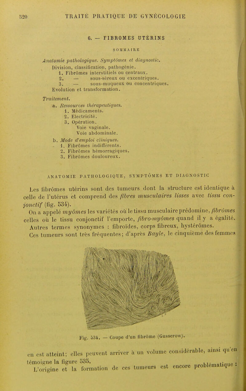 6. — FIBROMES UTÉRINS SOMMAIRE Anatomie pathologique. Symptômes et diagnostic. Division, classification, pathogénie. 1. Fibromes interstitiels ou centraux. 2. — sous-séreux ou excentriques. 3. — sous-muqueux ou concentriques. Evolution et transformation. Traitement. a. Ressources thérapeutiques. 1. Médicaments. 2. Electricité. 3. Opération. Voie vaginale. Voie abdominale. b. Mode d'emploi cliniques. 1. Fibromes indifférents. 2. Fibromes hémorragiques. 3. Fibromes douloureux. ANATOMIE PATHOLOGIQUE, SYMPTÔMES ET DIAGNOSTIC Les fibromes utérins sont des tumeurs dont la structure est identique à celle de l'utérus et comprend des fibres musculaires lisses avec tissu con- jonctif (fig. §34). On a appelé rayâmes les variétés ou le tissu musculaire prédomine, fibromes celles où le tissu conjonctif l'emporte, fibro-myômes quand il y a égalité. Autres termes synonymes : fibroïdes, corps fibreux, hystérômes. Ces tumeurs sont très fréquentes; d'après Bayle, le cinquième des femmes I Fig. 534. — Coupe d'un fibrome (Gusserow). en es! éteint; elles peuvent arriver à un volume considérable, ainsi qu'en témoigne la figure 53o. ,..•„„ . L'origine et la formation de ces tumeurs est encore problématique .