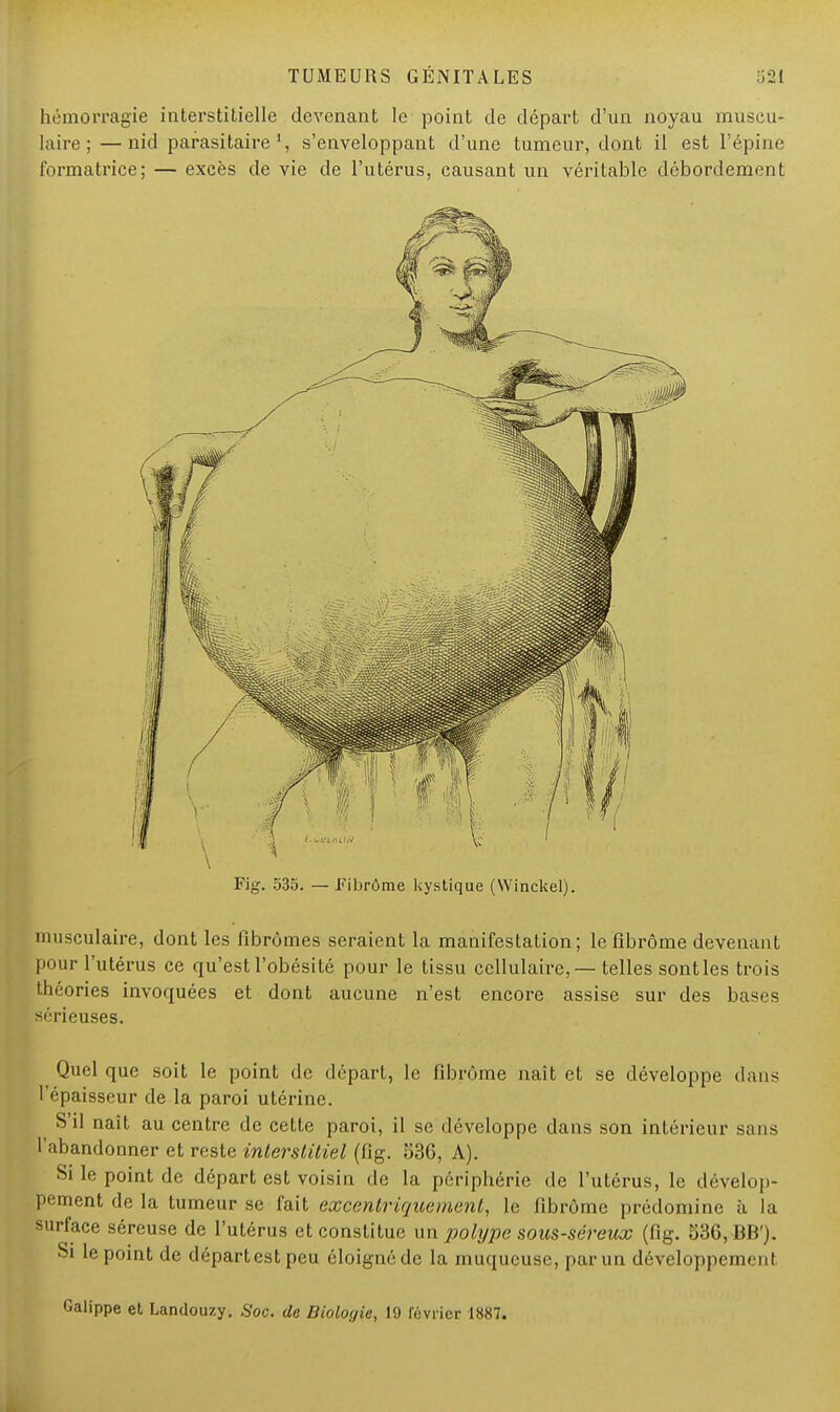 hémorragie interstitielle devenant le point de départ d'un noyau muscu- laire ;— nid parasitaires'enveloppant d'une tumeur, dont il est l'épine formatrice; — excès de vie de l'utérus, causant un véritable débordement Fig. 535. — Fibrôme kystique (Winckel) musculaire, dont les fibromes seraient la manifestation; le fibrome devenant pour l'utérus ce qu'est l'obésité pour le tissu cellulaire, — telles sont les trois théories invoquées et dont aucune n'est encore assise sur des bases sérieuses. Quel que soit le point de départ, le fibrome naît et se développe dans l'épaisseur de la paroi utérine. S'il naît au centre de cette paroi, il se développe dans son intérieur sans l'abandonner et reste interstitiel (fig. 53G, A). Si le point de départ est voisin de la périphérie de l'utérus, le dévelop- pement de la tumeur se fait excenlriquemenl, le fibrome prédomine à la surface séreuse de l'utérus et constitue un polype sous-séreux (fig. 536, BB). Si le point de départ est peu éloigné de la muqueuse, par un développemenl ippe et Landouzy. Soc. de Biologie, 19 février 1887.