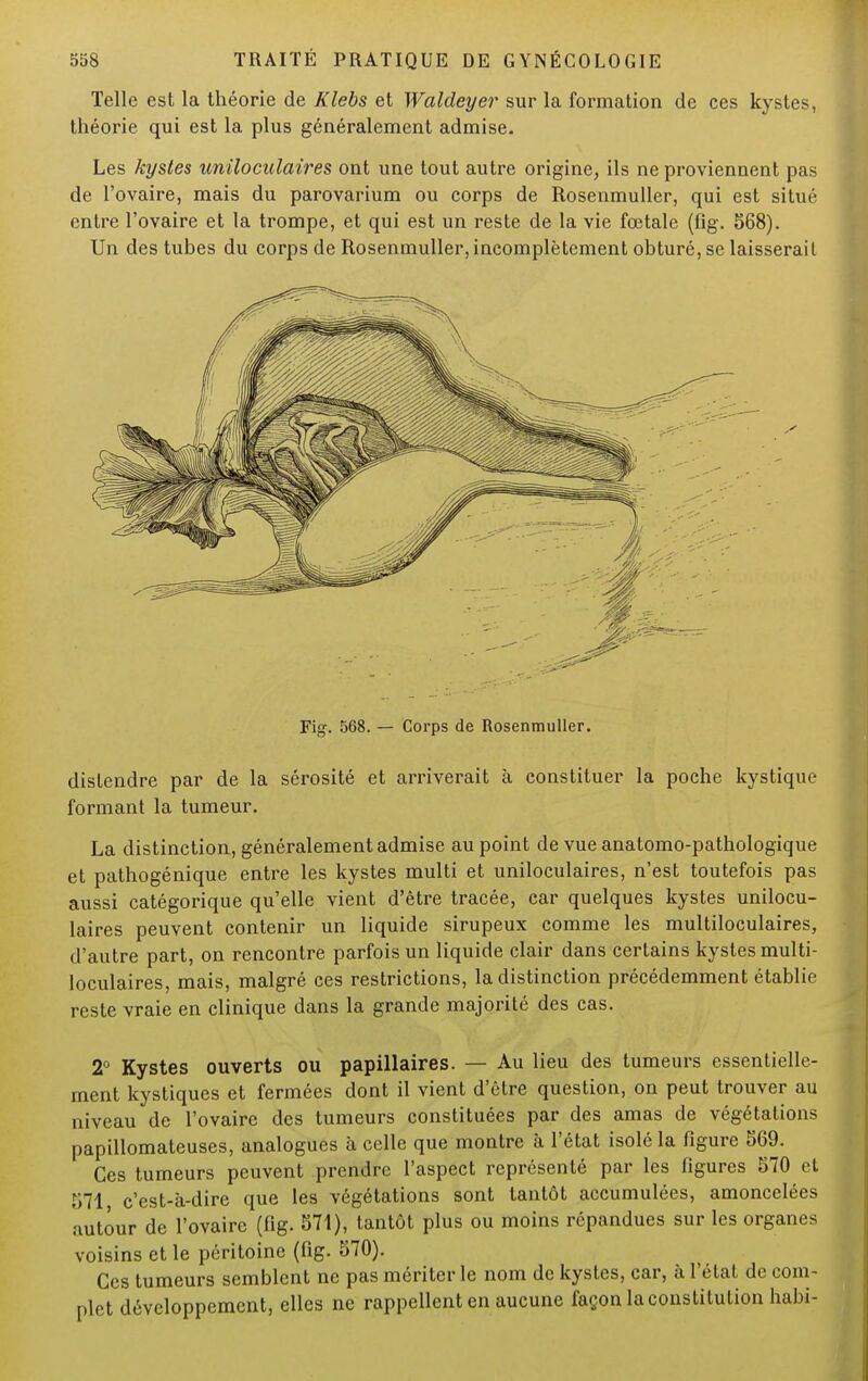 Telle est la théorie de Klebs et Waldeyer sur la formation de ces kystes, théorie qui est la plus généralement admise. Les kystes uniloculaires ont une tout autre origine, ils ne proviennent pas de l'ovaire, mais du parovarium ou corps de Rosenmuller, qui est situé entre l'ovaire et la trompe, et qui est un reste de la vie fœtale (fig. 568). Un des tubes du corps de Rosenmuller, incomplètement obturé, se laisserait Fig. 568. — Corps de Rosenmuller. distendre par de la sérosité et arriverait à constituer la poche kystique formant la tumeur. La distinction, généralement admise au point de vue anatomo-pathologique et pathogénique entre les kystes multi et uniloculaires, n'est toutefois pas aussi catégorique qu'elle vient d'être tracée, car quelques kystes unilocu- laires peuvent contenir un liquide sirupeux comme les multiloculaires, d'autre part, on rencontre parfois un liquide clair dans certains kystes multi- loculaires, mais, malgré ces restrictions, la distinction précédemment établie reste vraie en clinique dans la grande majorité des cas. 2° Kystes ouverts ou papillaires. — Au lieu des tumeurs essentielle- ment kystiques et fermées dont il vient d'être question, on peut trouver au niveau de l'ovaire des tumeurs constituées par des amas de végétations papillomateuses, analogues à celle que montre à l'état isolé la figure 569. Ces tumeurs peuvent prendre l'aspect représenté par les figures 570 et 571 c'est-à-dire que les végétations sont tantôt accumulées, amoncelées autour de l'ovaire (fig. 571), tantôt plus ou moins répandues sur les organes voisins et le péritoine (fig. 570). Ces tumeurs semblent ne pas mériter le nom de kystes, car, à l'état de com- plet développement, elles ne rappellent en aucune façon la constitution habi-