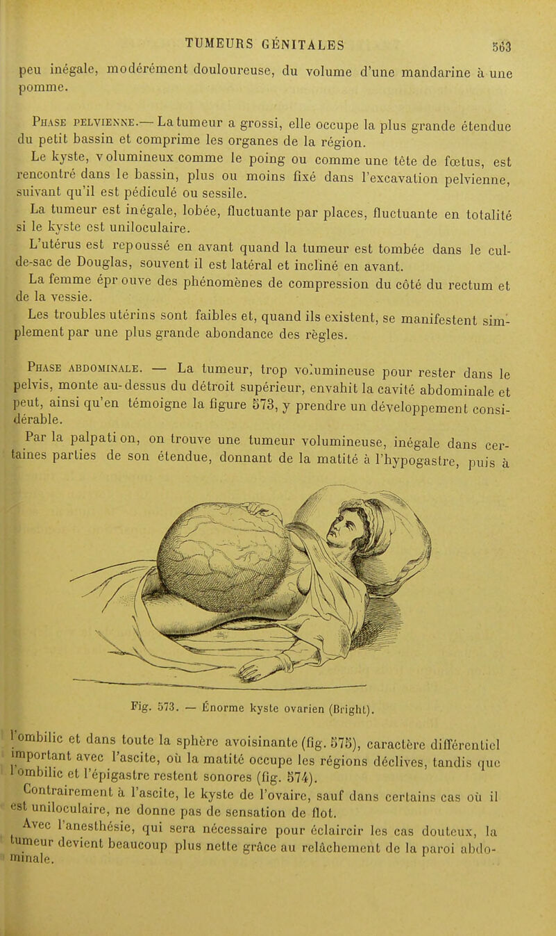 peu inégale, modérément douloureuse, du volume d'une mandarine à une pomme. Phase pelvienne.—La tumeur a grossi, elle occupe la plus grande étendue du petit bassin et comprime les organes de la région. Le kyste, volumineux comme le poing ou comme une tête de fœtus, est rencontré dans le bassin, plus ou moins fixé dans l'excavation pelvienne, suivant qu'il est pédiculé ou sessile. La tumeur est inégale, lobée, fluctuante par places, fluctuante en totalité si le kyste est uniloculaire. L'utérus est repoussé en avant quand la tumeur est tombée dans le cul- de-sac de Douglas, souvent il est latéral et incliné en avant. La femme épr ouve des phénomènes de compression du côté du rectum et de la vessie. Les troubles utérins sont faibles et, quand ils existent, se manifestent sim- plement par une plus grande abondance des règles. Phase abdominale. — La tumeur, trop volumineuse pour rester dans le pelvis, monte au-dessus du détroit supérieur, envahit la cavité abdominale et peut, ainsi qu'en témoigne la figure 573, y prendre un développement consi- dérable. Par la palpati on, on trouve une tumeur volumineuse, inégale dans cer- taines parties de son étendue, donnant de la matité à l'hypogastre, puis à Fig. 573. — Énorme kyste ovarien (Bright). 1 ombilic et dans toute la sphère avoisinante (fig. B7B), caractère différentiel important avec l'ascite, où la matité occupe les régions déclives, tandis que ! l ombilic et l'épigastre restent sonores (fig. 574). Contrairement à l'ascite, le kyste de l'ovaire, sauf dans certains cas où il est uniloculaire, ne donne pas de sensation de flot. Avec l'anesthésie, qui sera nécessaire pour éclaircir les cas douteux, la tumeur devient beaucoup plus nette grâce au relâchement de la paroi abdo- minale.