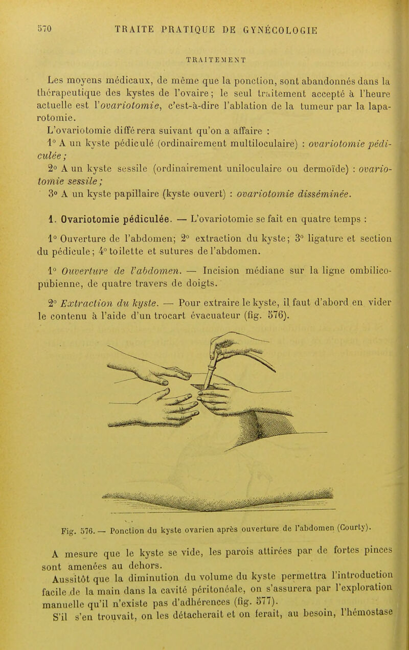 TRAITEMENT Les moyens médicaux, de même que la ponction, sont abandonnés dans la thérapeutique des kystes de l'ovaire; le seul traitement accepté à l'heure actuelle est l'ovariotomie, c'est-à-dire l'ablation de la tumeur par la lapa- rotomie. L'ovariotomie différera suivant qu'on a affaire : 1° A un kyste pédiculé (ordinairement multiloculaire) : ovariolomie pédi- culée ; 2° A un kyste sessile (ordinairement uniloculairc ou dermoïde) : ovario- lomie sessile; 3° A un kyste papillaire (kyste ouvert) : ovariotomie disséminée. i. Ovariotomie pédiculée. — L'ovariotomie se fait en quatre temps : 1° Ouverture de l'abdomen; 2° extraction du kyste; 3° ligature et section du pédicule; 4° toilette et sutures de l'abdomen. 1° Ouverture de l'abdomen. — Incision médiane sur la ligne ombilico- pubienne, de quatre travers de doigts. 2° Extraction du kyste. — Pour extraire le kyste, il faut d'abord en vider le contenu à l'aide d'un trocart évacuateur (fig. 576). Fig. 576.— Ponction du kyste ovarien après ouverture de l'abdomen (Courty). A mesure que le kyste se vide, les parois attirées par de fortes pinces sont amenées au dehors. Aussitôt que la diminution du volume du kyste permettra l'introduction facile de la main dans la cavité péritonéale, on s'assurera par l'exploration manuelle qu'il n'existe pas d'adhérences (fig. 577). S'il s'en trouvait, on les détacherait et on ferait, au besoin, l'hémostase