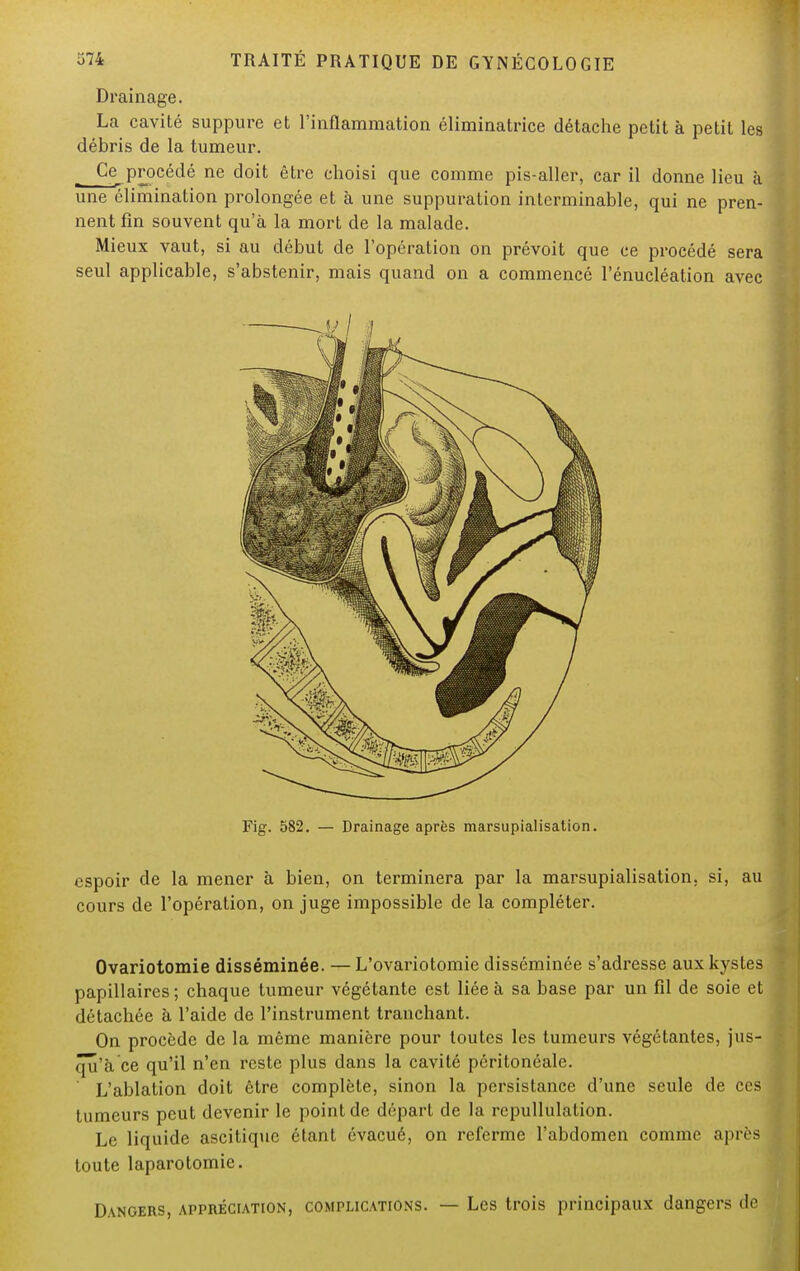 Drainage. La cavité suppure et l'inflammation éliminatrice détache petit à petit les débris de la tumeur. Ce_procédé ne doit être choisi que comme pis-aller, car il donne lieu à une élimination prolongée et à une suppuration interminable, qui ne pren- nent fin souvent qu'à la mort de la malade. Mieux vaut, si au début de l'opération on prévoit que ce procédé sera seul applicable, s'abstenir, mais quand on a commencé l'énucléation avec Fig. 582. — Drainage après marsupialisation. espoir de la mener à bien, on terminera par la marsupialisation. si, au cours de l'opération, on juge impossible de la compléter. Ovariotomie disséminée. — L'ovariotomie disséminée s'adresse aux kystes papillaires ; chaque tumeur végétante est liée à sa base par un fil de soie et détachée à l'aide de l'instrument tranchant. On procède de la même manière pour toutes les tumeurs végétantes, jus- qu'à ce qu'il n'en reste plus dans la cavité péritonéale. L'ablation doit être complète, sinon la persistance d'une seule de ces tumeurs peut devenir le point de départ de la repullulation. Le liquide ascitique étant évacué, on referme l'abdomen comme après toute laparotomie. Dangers, appréciation, complications. — Les trois principaux dangers de