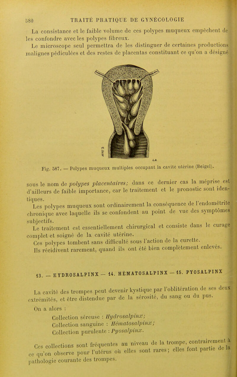 La consistance et le faible volume de ces polypes muqueux empêchent d| les confondre avec les polypes fibreux. Le microscope seul permettra de les distinguer de certaines productions malignes pédiculées et des restes de placentas constituant ce qu'on a désigné Fig. 587. — Polypes muqueux multiples occupant la cavité utérine (Beigel). sous le nom de polypes placentaires; dans ce dernier cas la méprise est d'ailleurs de faible importance, car le traitement et le pronostic sont iden- tiques. . Les polypes muqueux sont ordinairement la conséquence de 1 endometnte chronique avec laquelle ils se confondent au point de vue des symptômes subjectifs. Le traitement est essentiellement chirurgical et consiste dans le curage complet et soigné de la cavité utérine. Ces polypes tombent sans difficulté sous l'action de la curette. Ils récidivent rarement, quand ils ont été bien complètement enlevés. 13. _ HYDROSALPINX- 14. HÉMATOSALPINX 15. PYOSALPINX La cavité des trompes peut devenir kystique par l'oblitération de ses deux extrémités, et être distendue par de la sérosité, du sang ou du pus. On a alors : Collection séreuse : llydrosalpinx; Collection sanguine : u&matosalpinx; Collection purulente : Pyosalpinx. Ces collections sont fréquentes au niveau de la ce qu'on observe pour l'utérus où elles sont rares; elles font partie de pathologie courante des trompes.