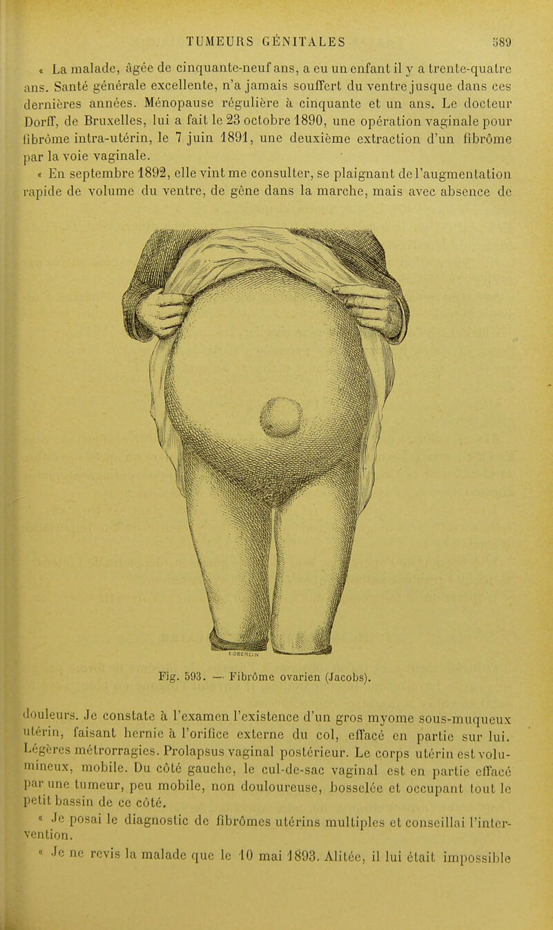 « La malade, âgée de cinquante-neuf ans, a eu un enfant il y a trente-quatre ans. Santé générale excellente, n'a jamais souffert du ventre jusque dans ces dernières années. Ménopause régulière à cinquante et un ans. Le docteur Dorff, de Bruxelles, lui a fait le 23 octobre 1890, une opération vaginale pour fibrome intra-utérin, le 7 juin 1891, une deuxième extraction d'un fibrome par la voie vaginale. « En septembre 1892, elle vint me consulter, se plaignant de l'augmentation rapide de volume du ventre, de gêne dans la marche, mais avec absence de Fig. 593. — Fibrôme ovarien (Jacobs). douleurs. Je constate à l'examen l'existence d'un gros myome sous-muqueux utérin, faisant hernie à l'orifice externe du col, effacé en partie sur lui. Légères métrorragies. Prolapsus vaginal postérieur. Le corps utérin est volu- 1 eux> mobile. Du côté gauche, le cul-de-sac vaginal est en partie effacé par une tumeur, peu mobile, non douloureuse, bosselée et occupant tout le petit bassin de ce côté. « Je posai le diagnostic de fibromes utérins multiples et conseillai l'inter- vention.  Je ne revis la malade que le 10 mai 1893. Alitée, il lui était impossible