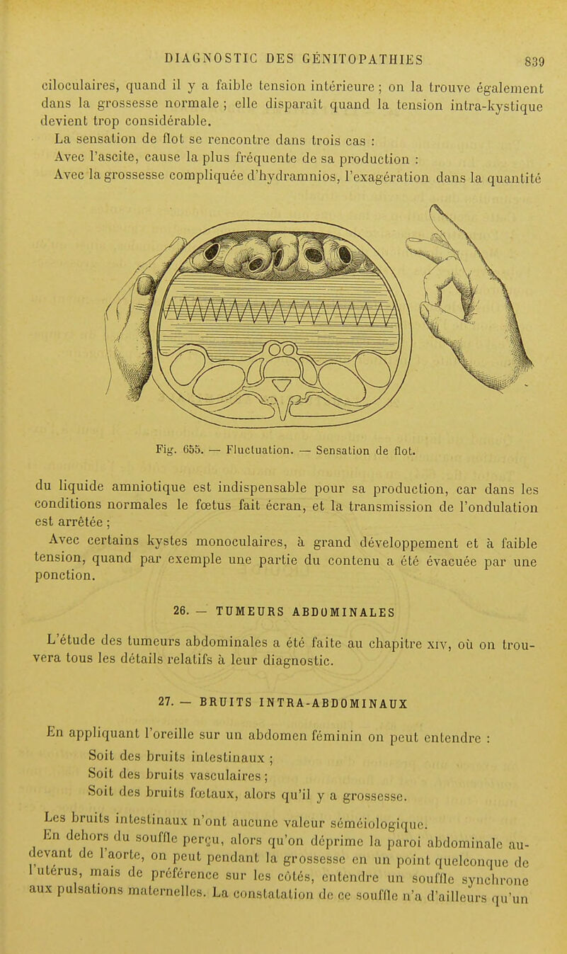 circulaires, quand il y a faible tension intérieure ; on la trouve également dans la grossesse normale ; elle disparaît quand la tension intra-kystique devient trop considérable. La sensation de flot se rencontre dans trois cas : Avec l'ascite, cause la plus fréquente de sa production : Avec la grossesse compliquée d'hydramnios, l'exagération dans la quantité Fig. 655. — Fluctuation. — Sensation de flot. du liquide amniotique est indispensable pour sa production, car dans les conditions normales le fœtus fait écran, et la transmission de l'ondulation est arrêtée ; Avec certains kystes monoculaires, à grand développement et à faible tension, quand par exemple une partie du contenu a été évacuée par une ponction. 26. - TUMEURS ABDOMINALES L'étude des tumeurs abdominales a été faite au chapitre xiv, où on trou- vera tous les détails relatifs à leur diagnostic. 27. — BRUITS INTRA-ABDOMINAUX En appliquant l'oreille sur un abdomen féminin on peut entendre : Soit des bruits intestinaux ; Soit des bruits vasculaires ; Soit des bruits fœtaux, alors qu'il y a grossesse. Les bruits intestinaux n'ont aucune valeur séméiologique. En dehors du souffle perçu, alors qu'on déprime la paroi abdominale au- devant de l'aorte, on peut pendant la grossesse en un point quelconque de 1 utérus, mais de préférence sur les côtés, entendre un souffle synchrone aux pulsations maternelles. La constatation de ce souffle n'a d'ailleurs qu'un
