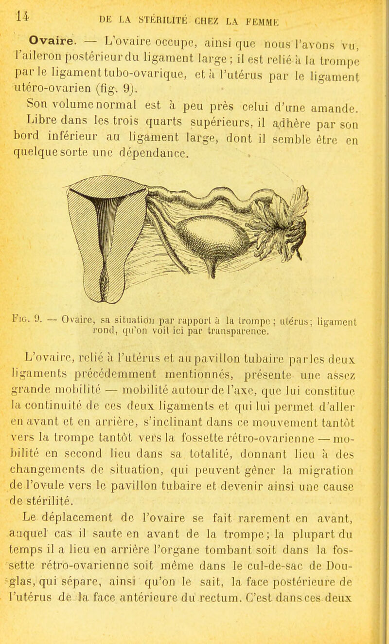 Ovaire. — L'ovaire occupe, ainsi que nous l'avons vu, l'aileron postérieur du ligament large ; il est relié à la trompé par le ligament tubo-ovarique, et à l'utérus par le ligament utéro-ovarien (fig. 9j. Son volume normal est à peu près celui d'irne amande. Libre dans les trois quarts supérieurs, il adhère par son bord inférieur au ligament large, dont il semble être en quelquesorte une dépendance. Fig. 9. — Ovaire, sa silualidii par rapporl à la Iroinpc; iilérus; ligament rond, qu'on voit ici par transparence. L'ovaire, relié à l'ulérus et au pavillon tubaire parles deux ligaments précédemment mentionnés, présente une assez grande mobilité — mobilité autour de Taxe, que lui constitue la continuité de ces deux ligaments et qui lui permet d'aller en avant et en arrière, s'inclinant dans ce mouvement tantôt vers la trompe tantôt vers la fossette rétro-ovarienne—mo- bilité en second lieu dans sa totalité, donnant lieu h des changements de situation, qui peuvent gêner la migration de l'ovule vers le pavillon tubaire et devenir ainsi une cause de stérilité. Le déplacement de l'ovaire se fait rarement en avant, auquel cas il saute en avant de la trompe; la plupart du temps il a lieu en arrière l'organe tombant soit dans la fos- sette rétro-ovarienne soit même dans le cul-de-sac de Dou- glas, qui sépare, ainsi qu'on le sait, la face postérieure de l'utérus de la face antérieure du rectum. C'est dans ces deux