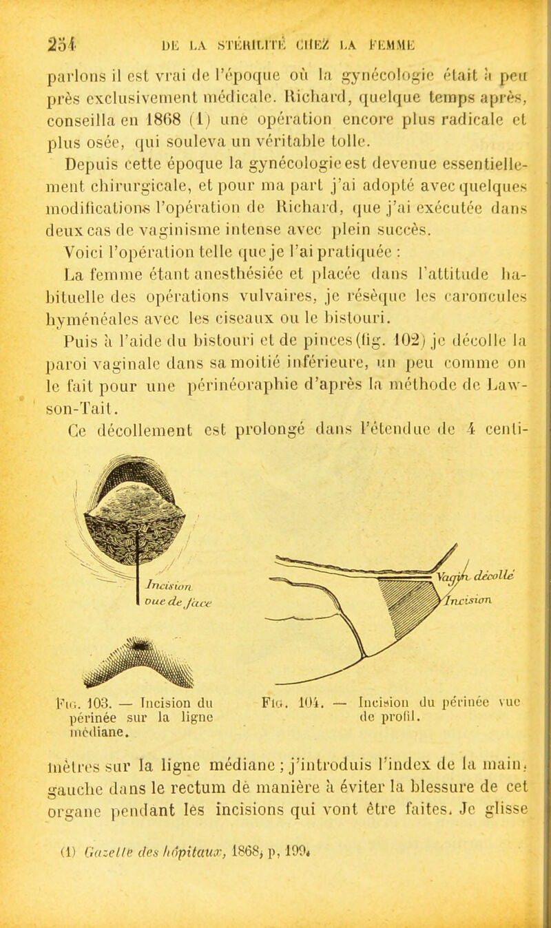 251 Dli I.A STliuiLITK OlIlîZ LA t'KMME parlons il est vrai de rr-poque où la gynécologie élait îi peu près exclusivement médicale. Richard, quelque temps après, conseilla en 1868 (i) une opération encore plus radicale et plus osée, qui souleva un véritable toile. Depuis cette époque la gynécologie est devenue essentielle- ment chirurgicale, et pour ma part j'ai adopté avec quelques modilication<s l'opération de Richard, (pie j'ai exécutée dans deux cas de vaginisme intense avec plein succès. Voici l'opération telle que je l'ai pratiquée : La femme étant anesthésiée et placée dans l'attitude ha- bituelle des opérations vulvaires, je résèque les caroncules hyménéales avec les ciseaux ou le bistouri. Puis à l'aide du bistouri et de pinces(hg. 10:2) je décolle la paroi vaginale dans sa moitié inférieure, un peu comme on le fait pour une périnéoraphie d'après la méthode de l.aw- son-Tait, Ce décollement est prolongé dans l'étendue de i- cenli- 1^1(1. 103. — îiicision du Fu.i. 104. — Iiicis^iou du périnée vue péi'inée sur la ligne de profil, médiane. mètres sur la ligne médiane ; j'introduis l'index de la main, gauche dans le rectum dè manière à éviter la blessure de cet organe pendant les incisions qui vont être faites. Je glisse (1) GazeUe des hôpitaux, 1868} p, 199*