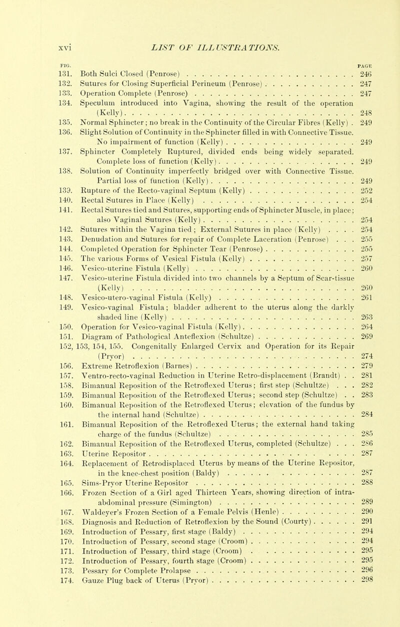FIG. PAGE 131. Both Sulci Closed (Penrose) 246 132. Sutures for Closing Superficial Perineum (Penrose) 247 133. Operation Complete (Penrose) 247 134. Speculum introduced into Vagina, showing the result of the operation (Kelly) 248 135. Normal Sphincter; no break in the Continuity of the Circular Fibres (Kelly) . 249 136. Slight Solution of Continuity in the Sphincter filled in with Connective Tissue. No impairment of function (Kelly) 249 137. Sphincter Completely Ruptured, divided ends being widely separated. Complete loss of function (Kelly) 249 138. Solution of Continuity imperfectly bridged over with Connective Tissue. Partial loss of function (Kelly) 249 139. Rupture of the Recto-vaginal Septum (Kelly) 252 140. Rectal Sutures in Place (Kelly) 254 141. Rectal Sutures tied and Sutures, supporting ends of Sphincter Muscle, in place; also Vaginal Sutures (Kelly) 254 142. Sutures within the Vagina tied ; External Sutures in place (Kelly) .... 254 143. Denudation and Sutures for repair of Complete Laceration (Penrose) . . . 255 144. Completed Operation for Sphincter Tear (Penrose) 255 145. The various Forms of Vesical Fistula (Kelly) 257 146. Vesico-uterine Fistula (Kelly) 260 147. Vesico-uterine Fistula divided into two channels by a Septum of Scar-tissue (Kelly) ~ 260 148. Vesico-utero-vaginal Fistula (Kelly) 261 149. Vesico-vaginal Fistula; bladder adherent to the uterus along the darkly shaded line (Kelly) 263 150. Operation for Vesico-vaginal Fistula (Kelly) 264 151. Diagram of Pathological Anteflexion (Schultze) 269 152. 153, 154, .155. Congenitally Enlarged Cervix and Operation for its Repair (Pryor) 274 156. Extreme Retroflexion (Barnes) 279 157. Ventro-recto-vaginal Reduction in Uterine Retro-displacement (Brandt) . . 281 158. Bimanual Reposition of the Retroflexed Uterus; first step (Schultze) . . . 282 159. Bimanual Reposition of the Retroflexed Uterus; second step (Schultze) . . 283 160. Bimanual Reposition of the Retroflexed Uterus; elevation of the fundus by the internal hand (Schultze) 284 161. Bimanual Reposition of the Retroflexed Uterus; the external hand taking charge of the fundus (Schultze) 285 162. Bimanual Reposition of the Retroflexed Uterus, completed (Schultze) . . . 286 163. Uterine Repositor .... 287 164. Replacement of Retrodisplaced Uterus by means of the Uterine Repositor, in the knee-chest position (Baldy) 287 165. Sims-Pryor Uterine Repositor 288 166. Frozen Section of a Girl aged Thirteen Years, showing direction of intra- abdominal pressure (Simington) 289 167. Waldeyer's Frozen Section of a Female Pelvis (Henle) 290 168. Diagnosis and Reduction of Retroflexion by the Sound (Courty) 291 169. Introduction of Pessary, first stage (Baldy) 294 170. Introduction of Pessary, second stage (Croom) .... 294 171. Introduction of Pessary, third stage (Croom) . 295 172. Introduction of Pessary, fourth stage (Croom) 295 173. Pessary for Complete Prolapse 296 174. Gauze Plug back of Uterus (Pryor) 298