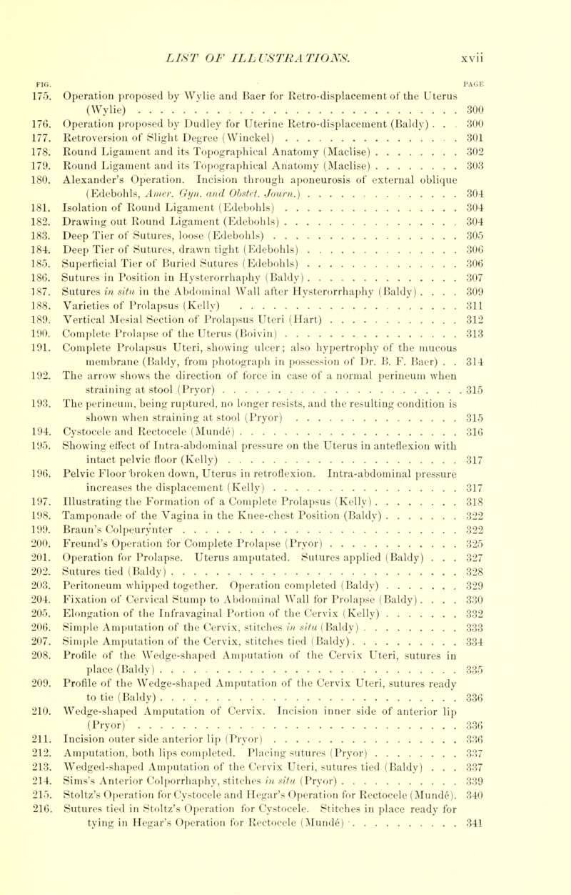 FIG. PAGE 175. Operation proposed by Wylie and Baer for Retro-displacement of the Uterus (Wylie) 300 176. Operation proposed by Dudley for Uterine Retro-displacement (Baldy) . . 300 177. Retroversion of Slight Degree (Winckel) 301 178. Round Ligament and its Topographical Anatomy (Maclise) 302 179. Round Ligament and its Topographical Anatomy (Maclise) 303 180. Alexander's Operation. Incision through aponeurosis of external oblique (Edebohls, Amer. Gyn. and Obstet. Journ.) 304 181. Isolation of Round Ligament (Edebohls) 304 182. Drawing out Round Ligament (Edebohls) 304 183. Deep Tier of Sutures, loose (Edebohls) 305 184. Deep Tier of Sutures, drawn tight (Edebohls) 306 185. Superficial Tier of Buried Sutures (Edebohls) 306 186. Sutures in Position in Hysterorrhaphy (Baldy) 307 187. Sutures in situ in the Abdominal Wall after Hysterorrhaphy (Baldy) . . . . 309 188. Varieties of Prolapsus (Kelly) 311 189. Vertical Mesial Section of Prolapsus Uteri (Hart) 312 190. Complete Prolapse of the Uterus (Boivin) 313 191. Complete Prolapsus Uteri, showing ulcer; also hypertrophy of the mucous membrane (Baldy, from photograph in possession of Dr. B. F. Baer) . . 314 192. The arrow shows the direction of force in case of a normal perineum when straining at stool (Pryor) 315 193. The perineum, being ruptured, no longer resists, and the resulting condition is shown when straining at stool (Pryor) 315 194. Cystocele and Rectocele (Munde) 316 195. Showing effect of Intra-abdominal pressure on the Uterus in anteflexion with intact pelvic floor (Kelly) 317 196. Pelvic Floor broken down, Uterus in retroflexion. Intra-abdominal pressure increases the displacement (Kelly) 317 197. Illustrating the Formation of a Complete Prolapsus (Kelly) 318 198. Tamponade of the Vagina in the Knee-chest Position (Baldy) 322 199. Braun's Colpeurynter 322 200. Freund's Operation for Complete Prolapse (Pryor) 325 201. Operation for Prolapse. Uterus amputated. Sutures applied (Baldy) . . . 327 202. Sutures tied (Baldy) 328 203. Peritoneum whipped together. Operation completed (Baldy) 329 204. Fixation of Cervical Stump to Abdominal Wall for Prolapse (Baldy). . . . 330 205. Elongation of the Infravaginal Portion of the Cervix (Kelly) 332 206. Simple Amputation of the Cervix, stitches in situ (Baldy) 333 207. Simple Amputation of the Cervix, stitches tied (Baldy) 334 208. Profile of the Wedge-shaped Amputation of the Cervix Uteri, sutures in place (Baldy) 335 209. Profile of the Wedge-shaped Amputation of the Cervix Uteri, sutures ready to tie (Baldy) 336 210. Wedge-shaped Amputation of Cervix. Incision inner side of anterior lip (Pryor)' 336 211. Incision outer side anterior lip (Pryor) 336 212. Amputation, both lips completed. Placing sutures (Pryor) 337 213. Wedged-shaped Amputation of the Cervix Uteri, sutures tied (Baldy) . . . 337 214. Sims's Anterior Colporrhaphy, stitches in situ (Pryor) 339 215. Stoltz's Operation for Cystocele and Hegar's Operation for Rectocele (Munde). 340 216. Sutures tied in Stoltz's Operation for Cystocele. Stitches in place ready for tying in Hegar's Operation for Rectocele (Munde) ' 341