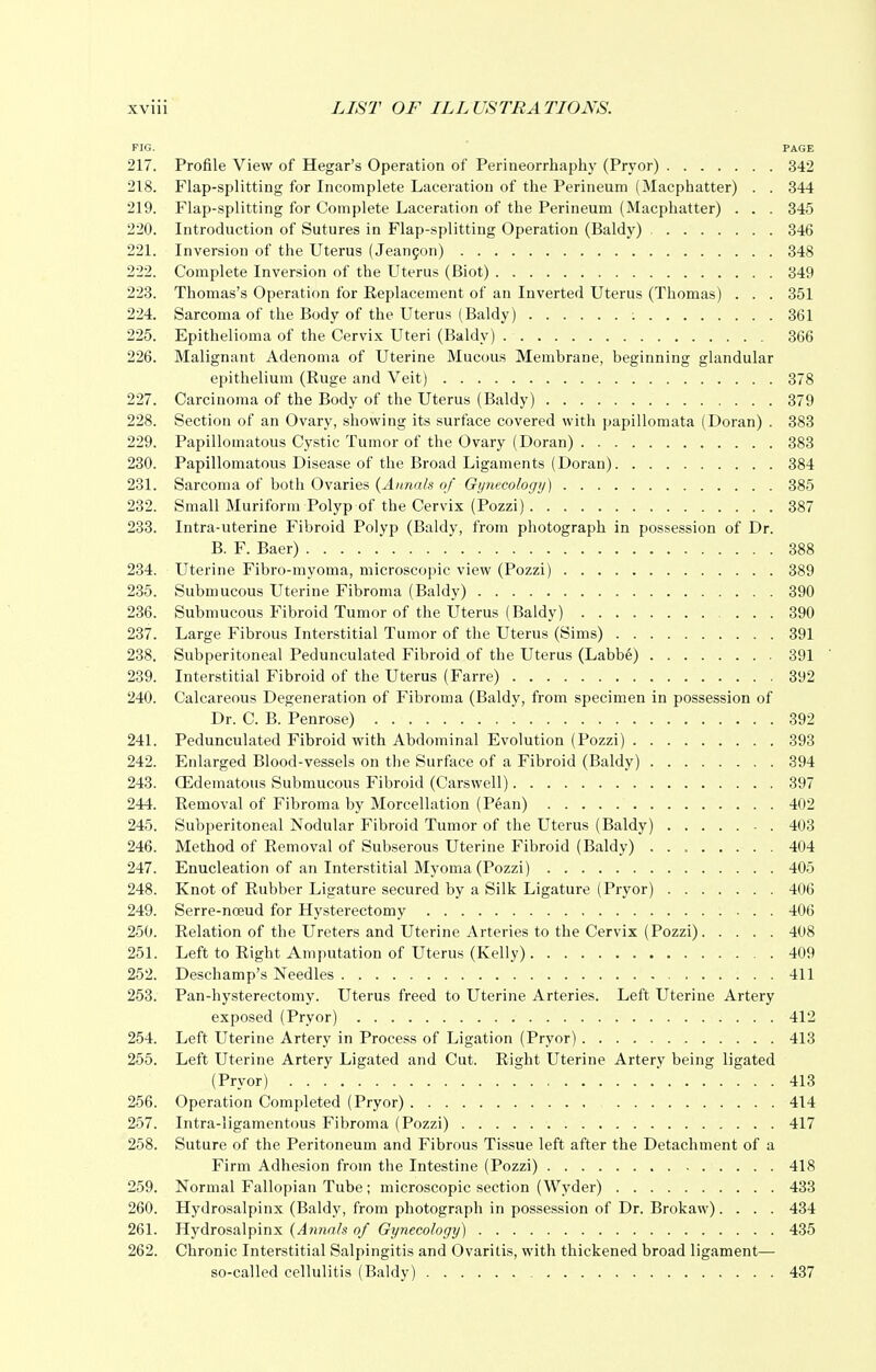 FIG. PAGE 217. Profile View of Hegar's Operation of Perineorrhaphy (Pryor) 342 218. Flap-splitting for Incomplete Laceration of the Perineum (Macphatter) . . 344 219. Flap-splitting for Complete Laceration of the Perineum (Macphatter) . . . 345 220. Introduction of Sutures in Flap-splitting Operation (Baldy) 346 221. Inversion of the Uterus (Jeancon) 348 222. Complete Inversion of the Uterus (Biot) 349 223. Thomas's Operation for Replacement of an Inverted Uterus (Thomas) . . . 351 224. Sarcoma of the Body of the Uterus (Baldy) ; 361 225. Epithelioma of the Cervix Uteri (Baldy) 366 226. Malignant Adenoma of Uterine Mucous Membrane, beginning glandular epithelium (Ruge and Veit) 378 227. Carcinoma of the Body of the Uterus (Baldy) 379 228. Section of an Ovary, showing its surface covered with papillomata (Doran) . 383 229. Papillomatous Cystic Tumor of the Ovary (Doran) 383 230. Papillomatous Disease of the Broad Ligaments (Doran) 384 231. Sarcoma of both Ovaries {Annals of Gynecology) 385 232. Small Muriform Polyp of the Cervix (Pozzi) 387 233. Intra-uterine Fibroid Polyp (Baldy, from photograph in possession of Dr. B. F. Baer) 388 234. Uterine Fibro-myoma, microscopic view (Pozzi) 389 235. Submucous Uterine Fibroma (Baldy) 390 236. Submucous Fibroid Tumor of the Uterus (Baldy) 390 237. Large Fibrous Interstitial Tumor of the Uterus (Sims) 391 238. Subperitoneal Pedunculated Fibroid of the Uterus (Labbe) 391 239. Interstitial Fibroid of the Uterus (Farre) 392 240. Calcareous Degeneration of Fibroma (Baldy, from specimen in possession of Dr. C. B. Penrose) 392 241. Pedunculated Fibroid with Abdominal Evolution (Pozzi) 393 242. Enlarged Blood-vessels on the Surface of a Fibroid (Baldy) 394 243. (Edematous Submucous Fibroid (Carswell) 397 244. Removal of Fibroma by Morcellation (Pean) 402 245. Subperitoneal Nodular Fibroid Tumor of the Uterus (Baldy) - . 403 246. Method of Removal of Subserous Uterine Fibroid (Baldy) . . , 404 247. Enucleation of an Interstitial Myoma (Pozzi) 405 248. Knot of Rubber Ligature secured by a Silk Ligature (Pryor) 406 249. Serre-noeud for Hysterectomy 406 250. Relation of the Ureters and Uterine Arteries to the Cervix (Pozzi) 408 251. Left to Right Amputation of Uterus (Kelly) 409 252. Deschamp's Needles 411 253. Pan-hysterectomy. Uterus freed to Uterine Arteries. Left Uterine Artery exposed (Pryor) 412 254. Left Uterine Artery in Process of Ligation (Pryor) 413 255. Left Uterine Artery Ligated and Cut. Right Uterine Artery being ligated (Pryor) 413 256. Operation Completed (Pryor) , , 414 257. Intraligamentous Fibroma (Pozzi) 417 258. Suture of the Peritoneum and Fibrous Tissue left after the Detachment of a Firm Adhesion from the Intestine (Pozzi) 418 259. Normal Fallopian Tube; microscopic section (Wyder) 433 260. Hydrosalpinx (Baldy, from photograph in possession of Dr. Brokaw).... 434 261. Hydrosalpinx (Annals of Gynecology) 435 262. Chronic Interstitial Salpingitis and Ovaritis, with thickened broad ligament— so-called cellulitis (Baldy) 437