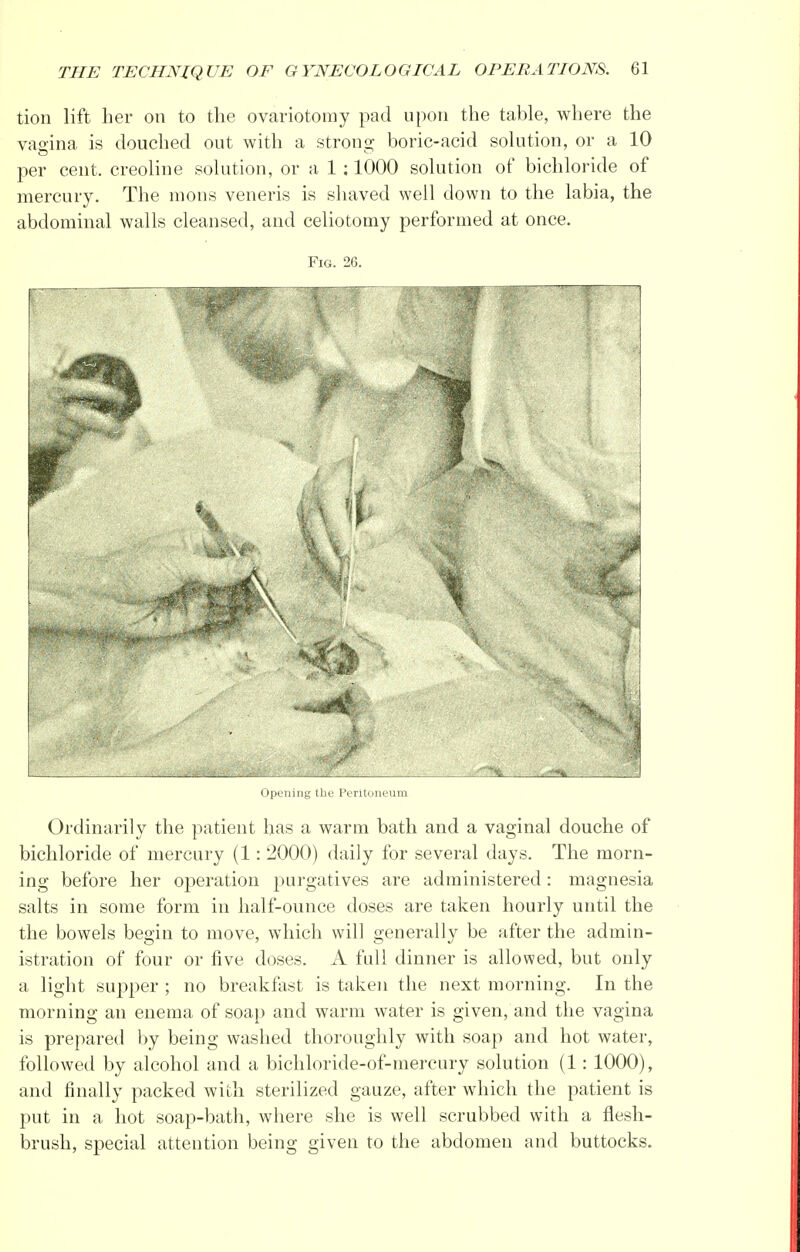 tion lift her on to the ovariotomy pad upon the table, where the vagina is douched out with a strong boric-acid solution, or a 10 per cent, creoline solution, or a 1 ; 1000 solution of bichloride of mercury. The mons veneris is shaved well down to the labia, the abdominal walls cleansed, and celiotomy performed at once. Fig. 26. Opening the Peritoneum Ordinarily the patient has a warm bath and a vaginal douche of bichloride of mercury (1: 2000) daily for several days. The morn- ing before her operation purgatives are administered: magnesia salts in some form in half-ounce doses are taken hourly until the the bowels begin to move, which will generally be after the admin- istration of four or five doses. A full dinner is allowed, but only a light supper ; no breakfast is taken the next morning. In the morning an enema of soap and warm water is given, and the vagina is prepared by being washed thoroughly with soap and hot water, followed by alcohol and a bichloride-of-mercury solution (1: 1000), and finally packed with sterilized gauze, after which the patient is put in a hot soap-bath, where she is well scrubbed with a flesh- brush, special attention being given to the abdomen and buttocks.
