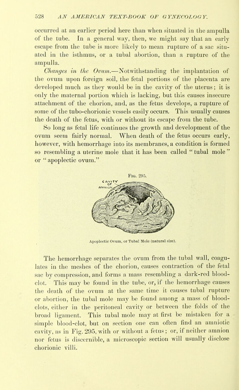 occurred at an earlier period here than when situated in the ampulla of the tube. In a general way, then, we might say that an early escape from the tube is more likely to mean rupture of a sac situ- ated in the isthmus, or a tubal abortion, than a rupture of the ampulla. Changes in the Ovum.—Notwithstanding the implantation of the ovum upon foreign soil, the fetal portions of the placenta are developed much as they would be in the cavity of the uterus; it is only the maternal portion which is lacking, but this causes insecure attachment of the chorion, and, as the fetus develops, a rupture of some of the tubo-chorionic vessels easily occurs. This usually causes the death of the fetus, with or without its escape from the tube. So long as fetal life continues the growth and development of the ovum seem fairly normal. When death of the fetus occurs early, however, with hemorrhage into its membranes, a condition is formed so resembling a uterine mole that it has been called  tubal mole 'r or  apoplectic ovum. Fig. 295. Apoplectic Ovum, or Tubal Mole (natural size). The hemorrhage separates the ovum from the tubal wall, coagu- lates in the meshes of the chorion, causes contraction of the fetal sac by compression, and forms a mass resembling a dark-red blood- clot. This may be found in the tube, or, if the hemorrhage causes the death of the ovum at the same time it causes tubal rupture or abortion, the tubal mole may be found among a mass of blood- clots, either in the peritoneal cavity or between the folds of the broad ligament. This tubal mole may at first be mistaken for a simple blood-clot, but on section one can often find an amniotic cavity, as in Fig. 295, with or without a fetus ; or, if neither amnion nor fetus is discernible, a microscopic section will usually disclose chorionic villi.