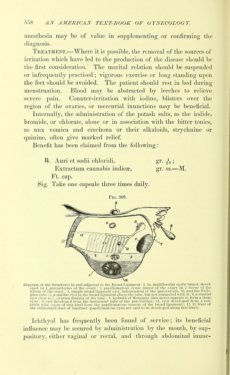 anesthesia may be of value in supplementing or confirming the diagnosis. Treatment.—Where it is possible, the removal of the sources of irritation which have led to the production of the disease should be the first consideration. The marital relation should be suspended or infrequently practised ; vigorous exercise or long standing upon the feet should be avoided. The patient should rest in bed during menstruation. Blood may be abstracted by leeches to relieve severe pain. Counter-irritation with iodine, blisters over the region of the ovaries, or mercurial inunctions may be beneficial. Internally, the administration of the potash salts, as the iodide, bromide, or chlorate, alone or in association with the bitter tonics, as nux vomica and cinchona or their alkaloids, strychnine or quinine, often give marked relief. Benefit has been claimed from the following: 3^. Auri et sodii chloridi, gr. ^; Extractum cannabis indicse, gr. ss.—M. Ft. cap. Sig. Take one capsule three times daily. Fig. 309. Diagram of the Structures in and adjacent to the Broad Ligament: 1, la, multilocular cystic tumor, devel- oped in 1, parenchyma of the ovary: S, papillomatous cystic tumor of the ovary in 2, tissue of the hilum of the ovary; 4, simple broad-ligament cyst, independent of the parovarium, 10, and the Fallo- pian tube ; 5, a similar cyst in the broad ligament above the tube, but not connected with it; 6, a similar cyst close to 7, ovarian fimbria of the tube : 8, hydatid of Morgagni (this never appears to form a large cyst); 9, cyst developed from the horizontal tube of the parovarium; 11, cyst developed from a ven- tricle tube (cysts of this kind form the papillomatous tumors of the broad ligament); 12, 13, tract of the obliterated duct of Gaertner (papillomatous cysts are said to be developed along this tract). Ichthyol has frequently been found of service; its beneficial influence may be secured by administration by the mouth, by sup- pository, either vaginal or rectal, and through abdominal inunc-