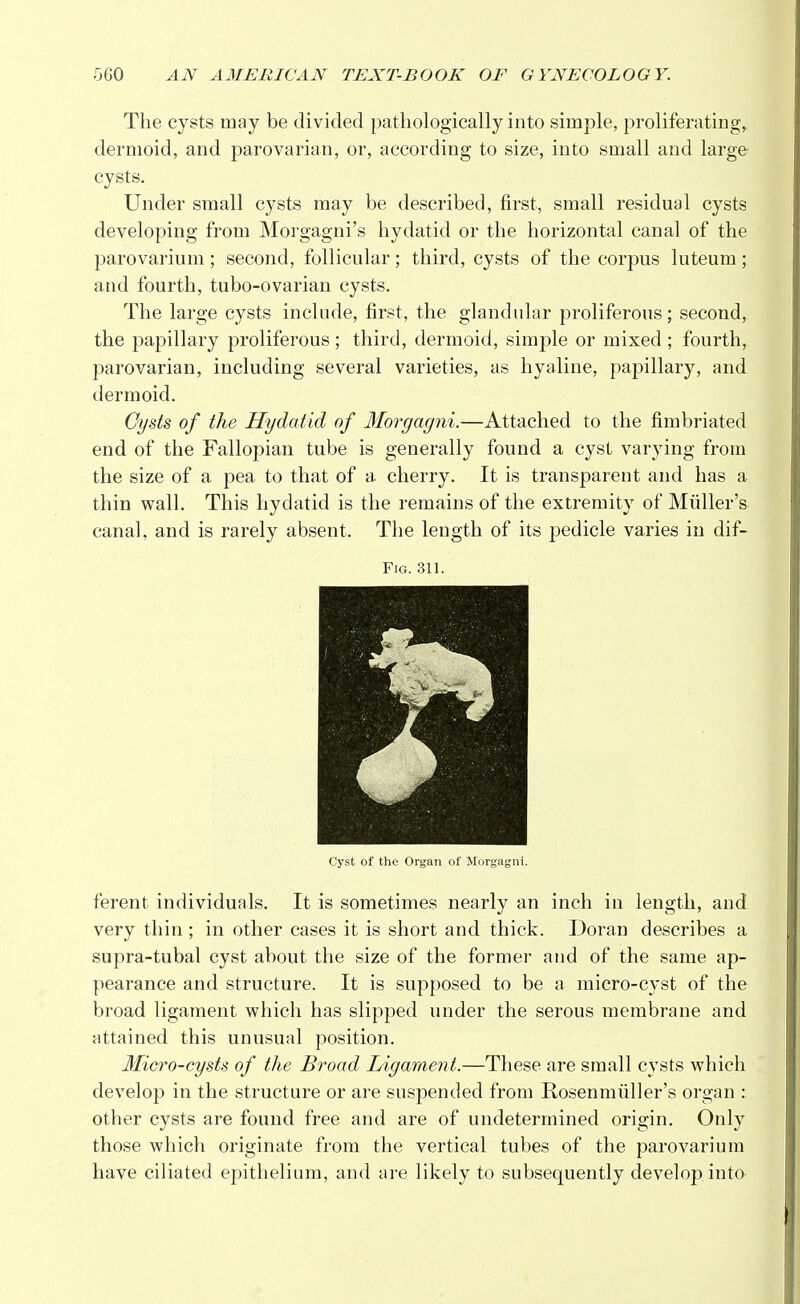 The cysts may be divided pathologically into simple, proliferating, dermoid, and parovarian, or, according to size, into small and large cysts. Under small cysts may be described, first, small residual cysts developing from Morgagni's hydatid or the horizontal canal of the parovarium; second, follicular; third, cysts of the corpus luteum; and fourth, tubo-ovarian cysts. The large cysts include, first, the glandular proliferous; second, the papillary proliferous; third, dermoid, simple or mixed; fourth, parovarian, including several varieties, as hyaline, papillary, and dermoid. Cysts of the Hydatid of Morgagni.—Attached to the fimbriated end of the Fallopian tube is generally found a cyst varying from the size of a pea to that of a, cherry. It is transparent and has a thin wall. This hydatid is the remains of the extremity of Midler's canal, and is rarely absent. The length of its pedicle varies in dif- Fig. 311. Cyst of the Organ of Morgagni. ferent individuals. It is sometimes nearly an inch in length, and very thin ; in other cases it is short and thick. Doran describes a supra-tubal cyst about the size of the former and of the same ap- pearance and structure. It is supposed to be a micro-cyst of the broad ligament which has slipped under the serous membrane and attained this unusual position. Micro-cysts of the Broad Ligament.—These are small cysts which develop in the structure or are suspended from Rosenmiiller's organ : other cysts are found free and are of undetermined origin. Only those which originate from the vertical tubes of the parovarium have ciliated epithelium, and are likely to subsequently develop into
