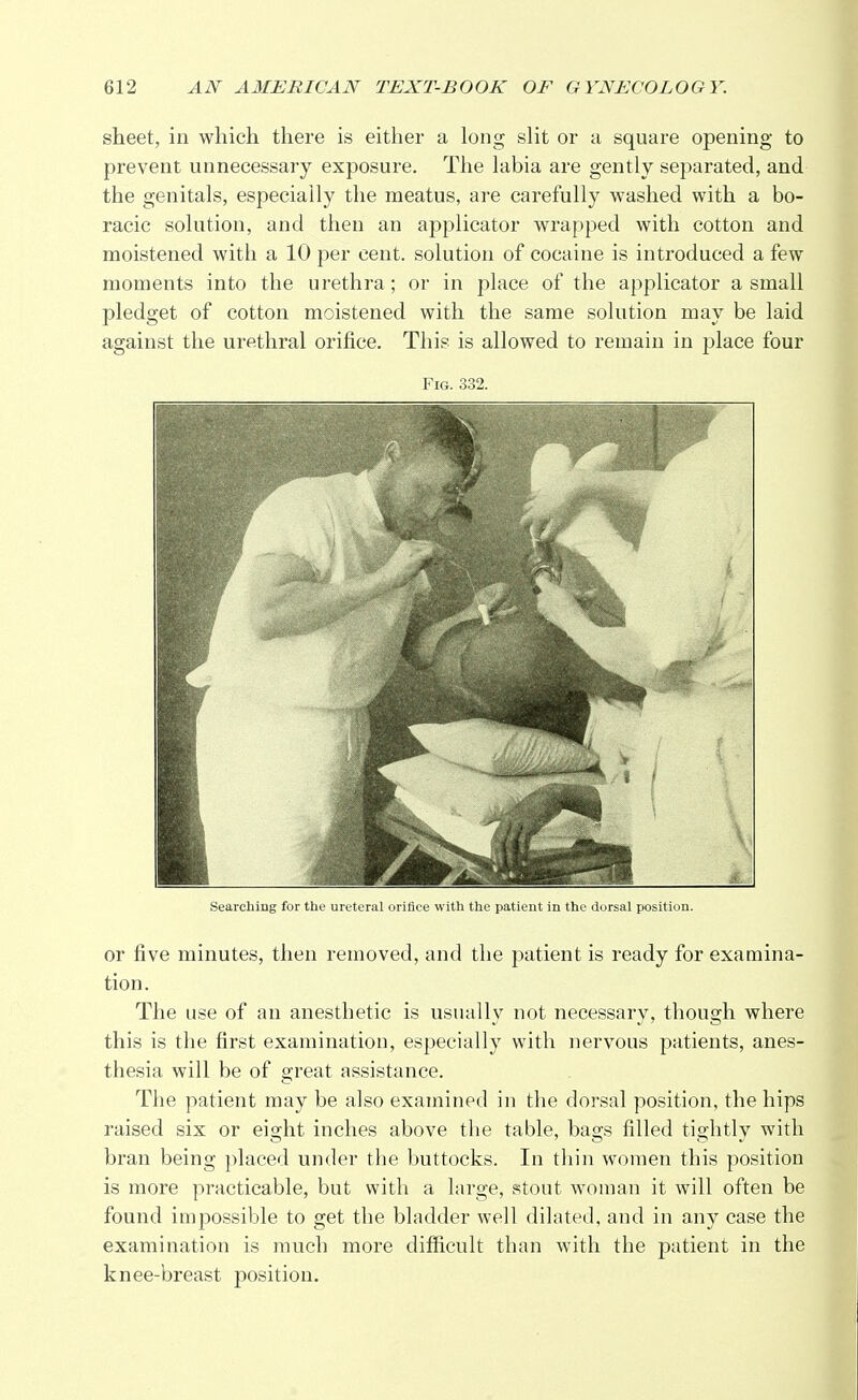 sheet, in which there is either a long slit or a square opening to prevent unnecessary exposure. The labia are gently separated, and the genitals, especially the meatus, are carefully washed with a bo- racic solution, and then an applicator wrapped with cotton and moistened with a 10 per cent, solution of cocaine is introduced a few moments into the urethra ; or in place of the applicator a small pledget of cotton moistened with the same solution may be laid against the urethral orifice. This is allowed to remain in place four Fig. 332. Searching for the ureteral orifice with the patient in the dorsal position. or five minutes, then removed, and the patient is ready for examina- tion. The use of an anesthetic is usually not necessary, though where this is the first examination, especially with nervous patients, anes- thesia will be of great assistance. The patient may be also examined in the dorsal position, the hips raised six or eight inches above the table, bags filled tightly with bran being placed under the buttocks. In thin women this position is more practicable, but with a large, stout woman it will often be found impossible to get the bladder well dilated, and in any case the examination is much more difficult than with the patient in the knee-breast position.