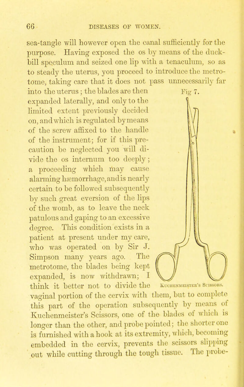 sea-tangle will however open the canal sufficiently for the purpose. Having exposed the os by means of the duck- bill speculum and seized one lip with a tenaculum, so as to steady the uterus, you proceed to introduce the metro- tome, taking care that it does not pass unnecessarily far into the uterus; the blades are then Fig 7. expanded laterally, and only to the limited extent previously decided on, and which is regulated by means of the screw affixed to the handle of the instrument; for if this pre- caution be neglected you will di- h vide the os internum too deeply; a proceeding which may cause alarming haemorrhage, and is nearly certain to be followed subsequently by such great eversion of the lips of the womb, as to leave the neck patulous and gaping to an excessive degree. This condition exists in a patient at present under my care, who was operated on by Sir J. Simpson many years ago. The metrotome, the blades being kept expanded, is now withdrawn; I think it better not to divide the kuchbnmei^ter's b< issoks. vaginal portion of the cervix with them, but to complete this part of the operation subsequently by means oi Kuchenmeister's Scissors, one of the blades of which is longer than the other, and probe pointed; the shorter one is furnished with a hook at its extremity , which, becoming embedded in the cervix, prevents the scissors slipping out while cutting through the tough tissue. The probe-