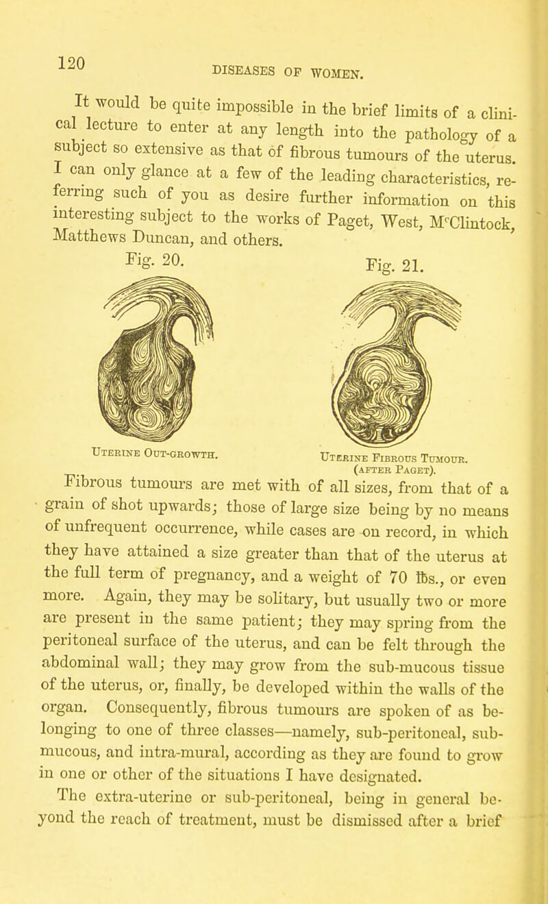 DISEASES OP WOMEN. It would be quite impossible in the brief limits of a clini- cal lecture to enter at any length into the pathology of a subject so extensive as that of fibrous tumours of the uterus I can only glance at a few of the leading characteristics, re- ferring such of you as desire further information on this interesting subject to the works of Paget, West, M'Clintock, Matthews Duncan, and others. Fig. 20. Uterine Out-growth. Uterine Fibrous Tumour. (after Paget). Fibrous tumours are met with of all sizes, from that of a grain of shot upwards; those of large size being by no means of unfrequent occurrence, while cases are -on record, in which they have attained a size greater than that of the uterus at the full term of pregnancy, and a weight of 70 lbs., or even more. Again, they may be solitary, but usually two or more are present in the same patient; they may spring from the peritoneal surface of the uterus, and can be felt through the abdominal wall; they may grow from the sub-mucous tissue of the uterus, or, finally, be developed within the walls of the organ. Consequently, fibrous tumours are spoken of as be- longing to one of three classes—namely, sub-peritoneal, sub- mucous, and intra-mural, according as they are found to grow in one or other of the situations I have designated. The extra-uterine or sub-peritoneal, being in general be- yond the reach of treatment, must be dismissed after a brief