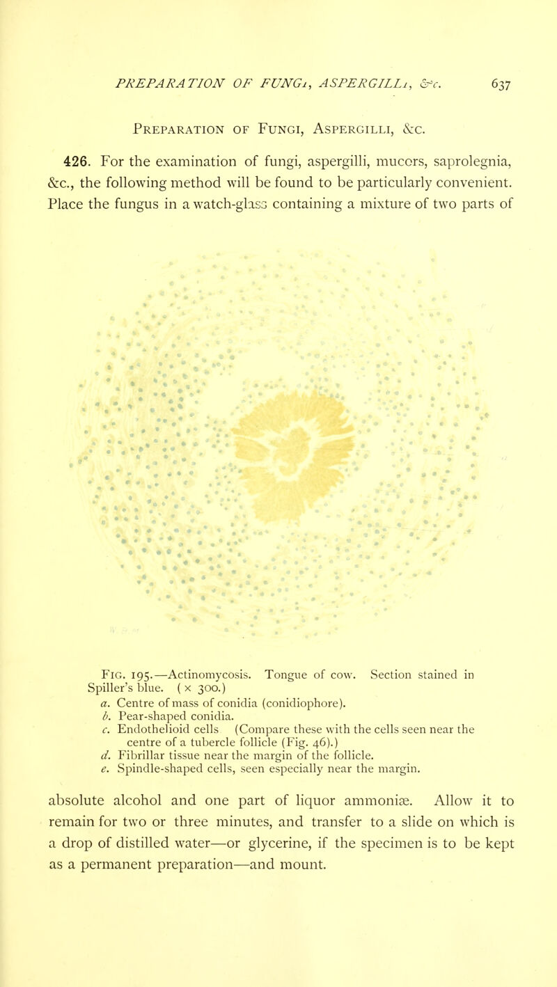 Preparation of Fungi, Aspergilli, &c. 426. For the examination of fungi, aspergilli, mucors, saprolegnia, &c., the following method will be found to be particularly convenient. Place the fungus in a watch-ghsG containing a mixture of two parts of Fig. 195.—Actinomycosis. Tongue of cow. Section stained in Spiller's blue. { x 300.) a. Centre of mass of conidia (conidiophore). l>. Pear-shaped conidia. c. Endothelioid cells (Compare these with the cells seen near the centre of a tubercle follicle (Fig. 46).) d. Fibrillar tissue near the margin of the follicle. e. Spindle-shaped cells, seen especially near the margin. absolute alcohol and one part of liquor ammoniae. Allow it to remain for two or three minutes, and transfer to a slide on which is a drop of distilled water—or glycerine, if the specimen is to be kept as a permanent preparation—and mount.
