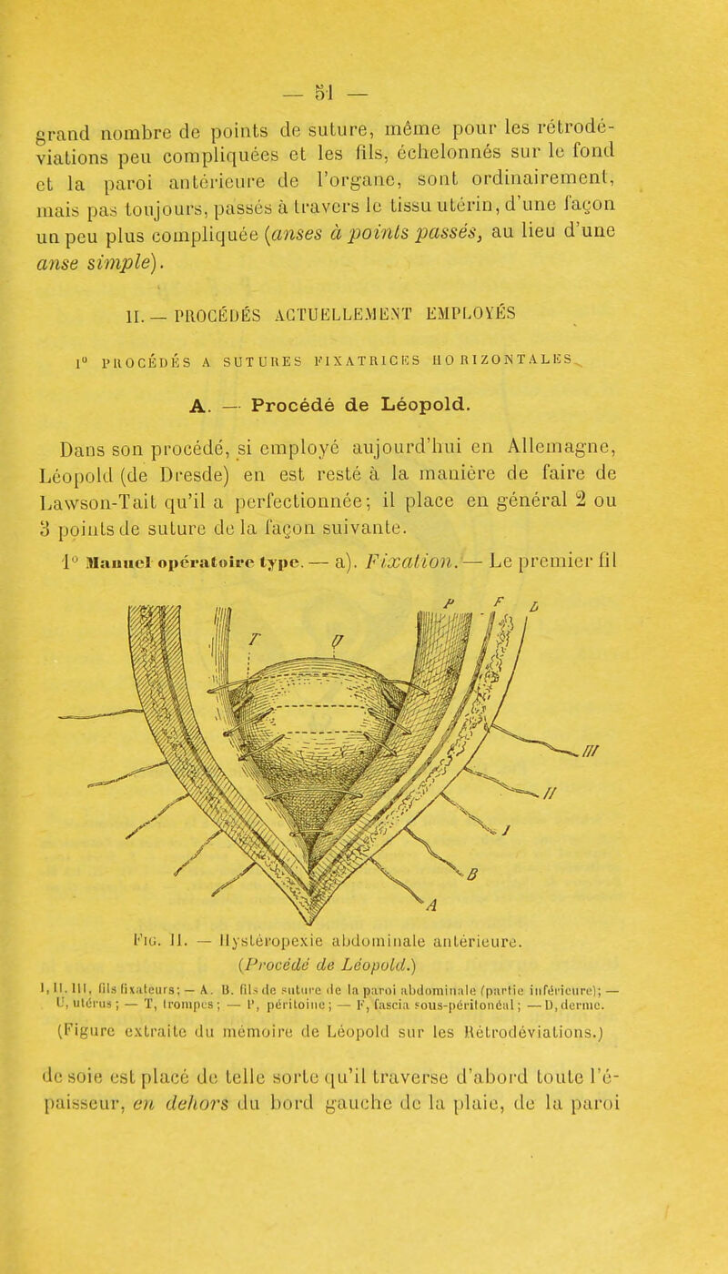 grand nombre de points de suture, même pour les rétrodé- viations peu compliquées et les fils, échelonnés sur le fond et la paroi antérieure de l'organe, sont ordinairement, mais pas toujours, passés à travers le tissu utérin, d'une façon un peu plus compliquée (anses à points passés, au lieu d'une anse simple), II. — PllOCÉDÉS ACTUELLEMENT EMPLOYÉS 1 PllOCÉDÉS A SUTURES 1 X A T R l G iC S II 0 H 1 Z 0 N T A L IC A. — Procédé de Léopold. Dans son procédé, si employé aujourd'hui en Allemagne, Léopold (de Dresde) en est resté à la manière de faire de Lawson-Tait qu'il a perfectionnée; il place en général 2 ou 3 points de suture de la façon suivante. i'^ Mauiici opératoire type. — a). Fixation. —• Le premier fil Eiu. ]]. — llysléropexie abdominale antérieure. (Procédé de Léopold.) 1,11.111, fils fixateurs; — A. U. fils de Piitiire île la paroi abdomiiiiile (partie iiiférioiire); — U, utérus; — T, trompes ; — 1', péritoine; — I', fascia fous-péritoiiéal ; —1), derme. (Figure e.\lraitc du mémoire de Léopold sur les Rélrodévialions.) de soie est placé de telle sorte qu'il traverse d'abord toute l'é- paisseur, en dehors du bord gauche de la plaie, de la paroi