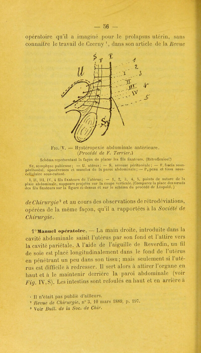 — 86 - opératoire qu'il a imagine pour le prolapsus ulcrin, sans connaître le travail de Gzerny ', dans son article de la Revue {Procédé de F. Terrier.) Schéma représentant la façon de placer les fils fixateurs. (Rétroflexion.) Sv. svmphyse pubienne; — U. utérus; — S, séreuse péritonéale; — F. fascia sous- périton'éal. aponévroses et muscles de la paroi abdominale ; —1', peau et tissu sous- celLu_laire sous-cutané. I, II, ni, IV, 4 fds Pixatours de l'utérus; — 1, 2, 3, 4, 5, points de suture de la plaie abilominalc, supposés projetés sur la coupe verticale. (Compartîz la place des nœuds des fils fixateurs sur la figure ci-dessus et sur le schéma du procédé de Lèopold.) de Chirurgie^ et au cours des observations de rétrodéviations. opérées de la même façon, qu'il a rapportées à la Société de Chirurgie. 1°Manuel opératoîx-e. — La main droite, introduite dans la cavité abdominale saisit l'utérus par son fond et l'attire vers la cavité pariétale. A l'aide de l'aiguille de Reverdin, un fil de soie est placé longitudinalement dans le fond de l'utérus en pénétrant un peu dans son tissu; mais seulement si l'uté- rus est difficile h. redresser. Il sert alors à attirer l'organe en haut et à le maintenir derrière la paroi abdominale (voir Fig. IV, S). Les intestins sont refoulés en haut et en arrière à • Il n'était pas publié d'ailleurs. = Revue de Chirurgie, n 3, 10 mars 1889, p. 197. » Voir J3uU. de la Soc. de Chir.