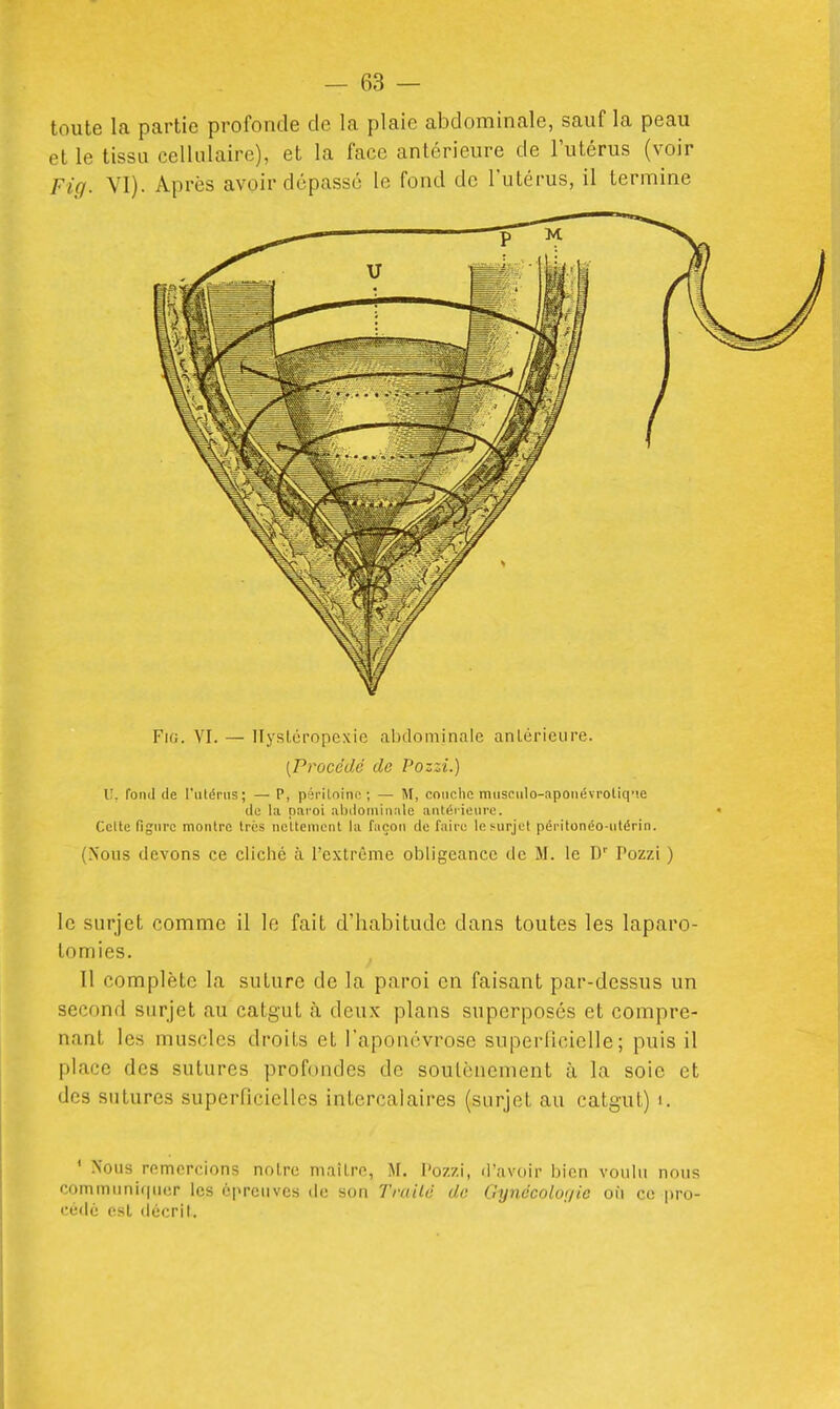 toute la partie profonde de la plaie abdominale, sauf la peau et le tissa cellulaire), et la face antérieure de l'utérus (voir Fig. VI). Après avoir dépassé le fond de l'utérus, il termine FiG. VI. — Ilysloropexie aI)dominale antérieure. [Procédé de Pozzi.) U. Tond de l'utérus; — P, pâriLoinn ; — M, conclic muscuIo-aponévrotiq.e do la paroi :il)tlorniMi\le antérieui-o. Celte figure montre très nettement la façon do l'aire le surjet péritonéo-utérin. (Nous devons ce cliché à l'extrême obligeance de M. le D'' Pozzi ) le surjet comme il le fait d'habitude dans toutes les laparo- lomies. 11 complète la suture de la paroi en faisant par-dessus un second surjet au catgut à deux plans superposés et compre- nant les muscles droits et l'aponévrose supernciclle ; puis il place des sutures profondes de soulcnenient à la soie et des sutures superficielles intercalaires (surjet au catgut) i. ' Nous remercions notre maître, M. l'ozzi, il'avoir iiicn voulu nous commnnif(ucr les épreuves de son Trailé de Oynécoluj/ic où ce pro- cédé est décrit.