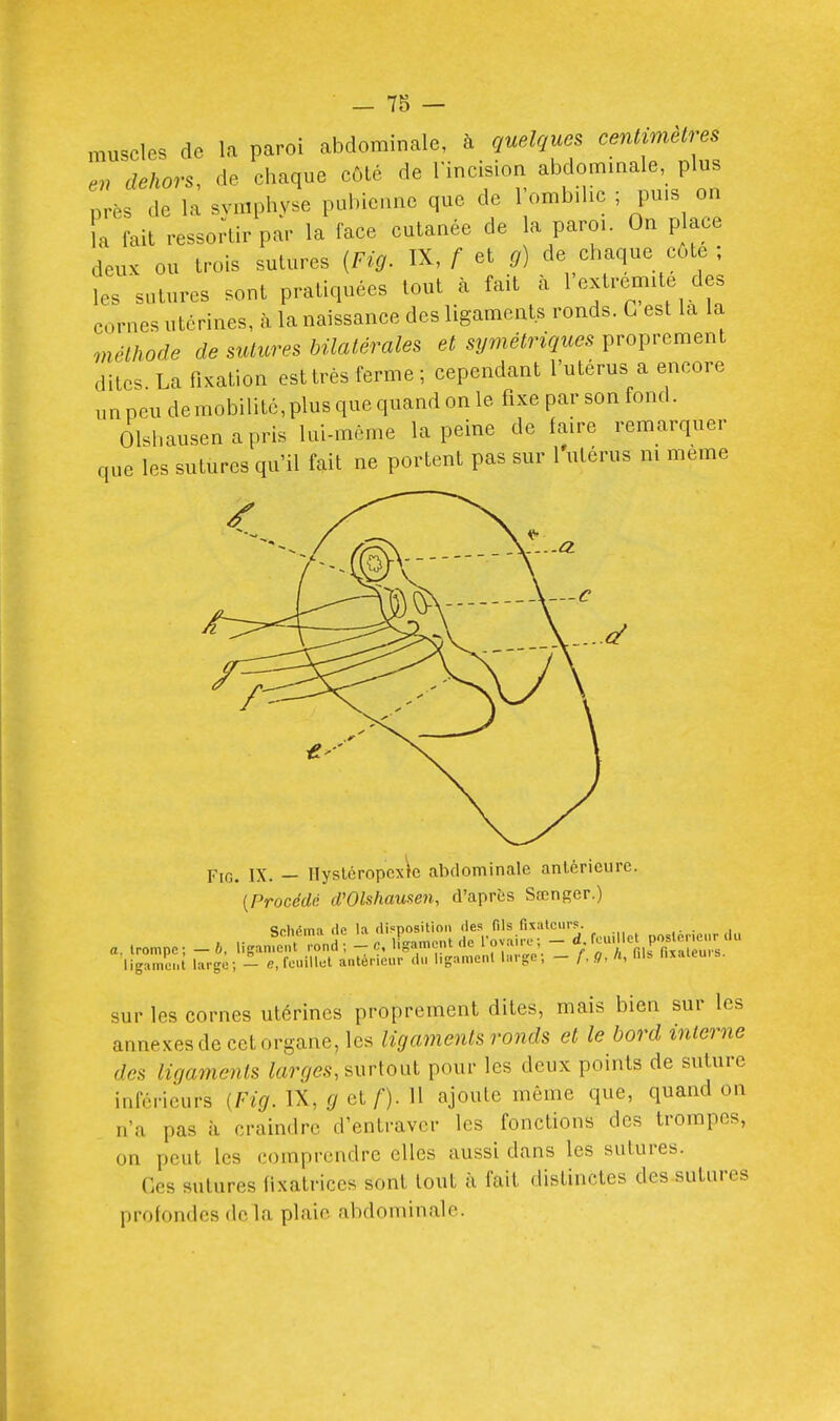muscles de la paroi abdominale, à quelques cenlimèlres en dehors, de chaque côlé de Tincision abdommale, plus près de la svmphyse pubienne que de l'ombilic ; puis on ïa fait ressoHir par la face cutanée de la paroi. On place deux ou trois sutures [Fig. IX, f et g) de chaque côte ; les'sutures sont pratiquées tout à fait à l'extrémité des cornes utérines, à la naissance des ligaments ronds. G est la la méthode de sutures bilatérales et symétriques proprement dites La fixation est très ferme; cependant l'utérus a encore un peu demobilitc,plus que quand on le fixe par son fond. Olshausenapris lui-même la peine de faire remarquer que les sutures qu'il fait ne portent pas sur l'utérus ni même Fig. IX. — IlysléropcxW abdominale antérieure. [Procédé d'Olshausen, d'après Sœnger.) Sfhéma (le la (li^'position (les fils fixateurs. , „„H . ^1 1 o-amoiit (le Tovaire: — d.rouilict postérieur du a. trompe; —6. ligament rond; — c, ligam(^nt ne • , fils fixateurs, ligament large; - e, feuillet antérieur du ligament large, - f. .«?, /», nxaieuis sur les cornes utérines proprement dites, mais bien sur les annexes de cet organe, les ligaments ronds et le bord interne des ligaments tordes, surtout pour les deux points de suture inférieurs [Fig. IX, g et f). Il ajoute môme que, quand on n'a pas à craindre d'entraver les fonctions des trompes, on peut les comprendre elles aussi dans les sutures. Ces sutures fixatrices sont tout à fait distinctes des sutures profondes de la plaie abdominale.