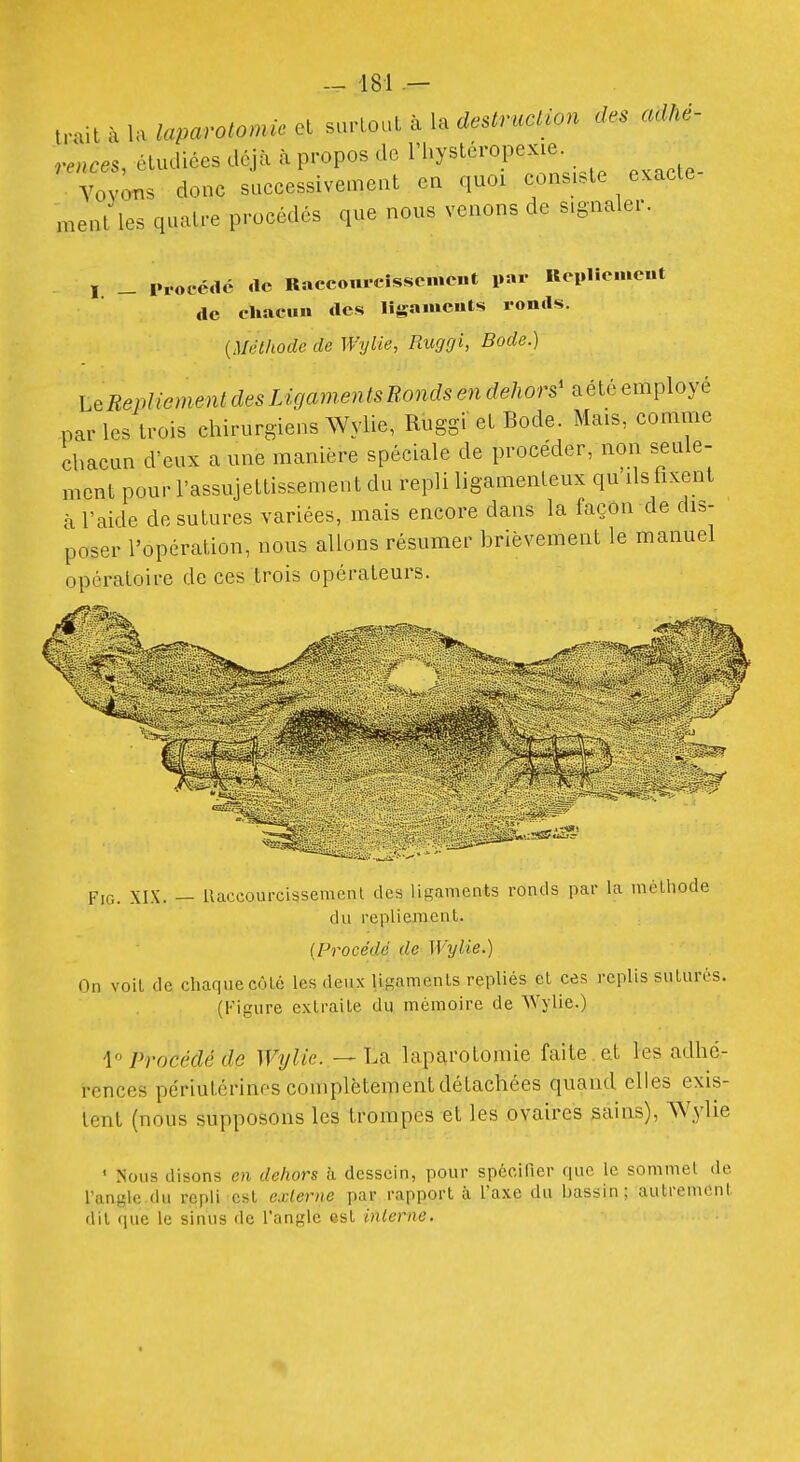 tPait à la laparotomie et surtout à la destruclwn des adhé- rences étudiées déjà à propos de Thystéropexie. y^J^ donc siccessivemeat ea quoi consiste exacte- ment les quatre procédés que nous venons de signaler. I _ Procédé .le Racco«rcîssc...e..t par UcplicHcnt de chacun des ligamcuts ronds. {Méthode de Wyiie, RugOh Bode.) LeRepliementdesLigam.entsRondse7ideJiors'^élà parles trois chirurgiens Wylie, Ruggi et Bode. Mais, comme chacun d'eux a une manière spéciale de procéder, non seule- ment pour l'assujettissement du repli ligamenteux qu ils fixent à l'aide de sutures variées, mais encore dans la façon de dis- poser l'opération, nous allons résumer brièvement le manuel opératoire de ces trois opérateurs. FiG. XIX. — Uaccourcissemenl des ligaments ronds par la mèlhode du repliement. {Procédé de Wylie.) On voit de chaque côLé les deux lisamenls repliés et ces replis suturés. (Figure extraite du mémoire de Wj-lie.) 4° Procédé de Wylie. —Lo. laparotomie faite . e.t les adhé- rences périutérinfs complètement détachées quand elles exis- tent (nous supposons les trompes et les ovaires sains), Wylie ' Nous disons en dehors h dessein, pour spécifier que le sommet de l'angle du repli est externe par rapport à l'axe du bassin; autrement dit ([ue le sinus de l'angle ast inlerne.