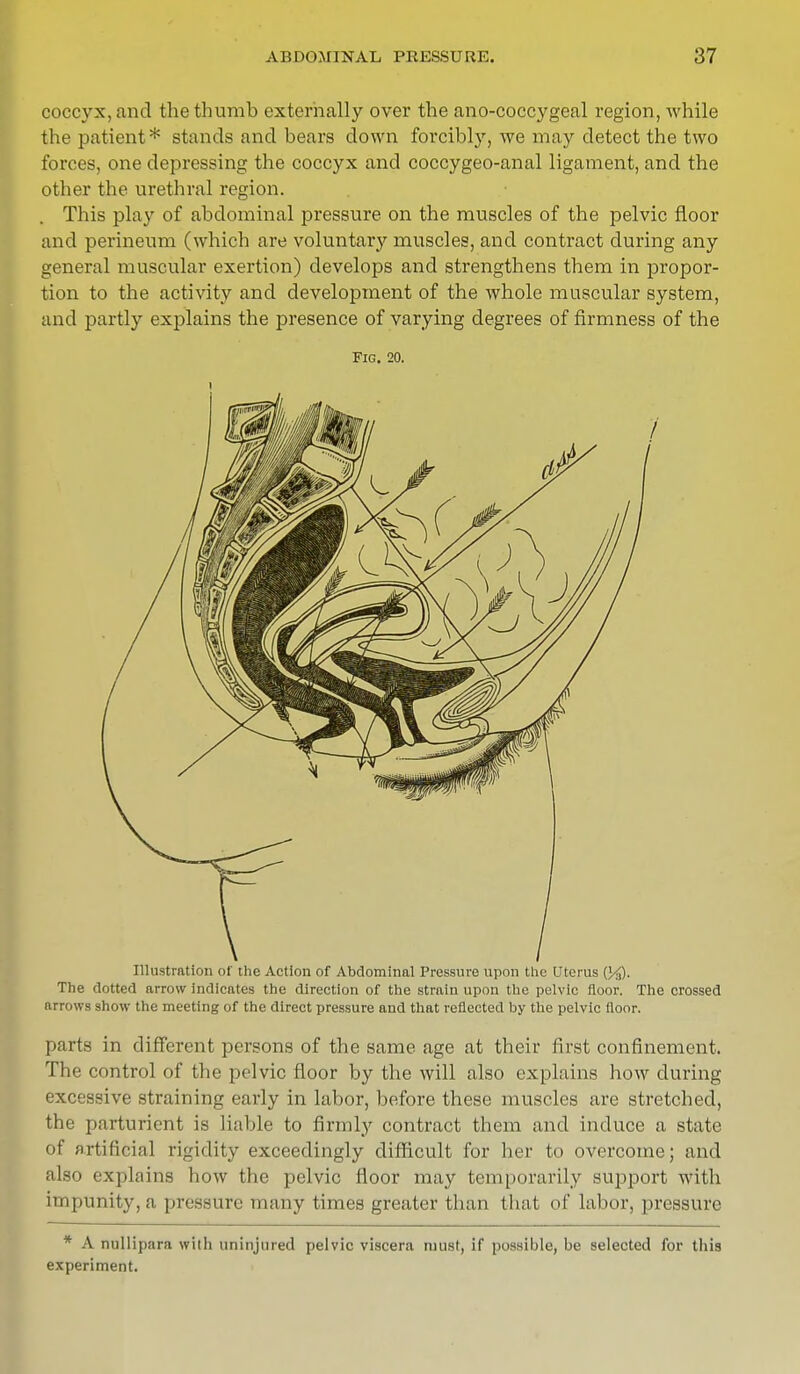 coccyx, and the thumb externally over the ano-coccygeal region, while the patient* stands and bears down forcibly, we may detect the two forces, one depressing the coccyx and coccygeo-anal ligament, and the other the urethral region. This play of abdominal pressure on the muscles of the pelvic floor and perineum (which are voluntary muscles, and contract during any general muscular exertion) develops and strengthens them in propor- tion to the activity and development of the whole muscular system, and partly explains the presence of varying degrees of firmness of the Fig. 20. Illustration of the Action of Abdominal Pressure upon the Uterus The dotted arrow indicates the direction of the strain upon the pelvic floor. The crossed arrows show the meeting of the direct pressure and that reflected by the pelvic floor. parts in different persons of the same age at their first confinement. The control of the pelvic floor by the will also explains how during excessive straining early in labor, before these muscles are stretched, the parturient is liable to firmly contract them and induce a state of artificial rigidity exceedingly difficult for her to overcome; and also explains how the pelvic floor may temporarily support with impunity, a pressure many times greater than that of labor, pressure * A nullipara with uninjured pelvic viscera tuust, if possible, be selected for this experiment.