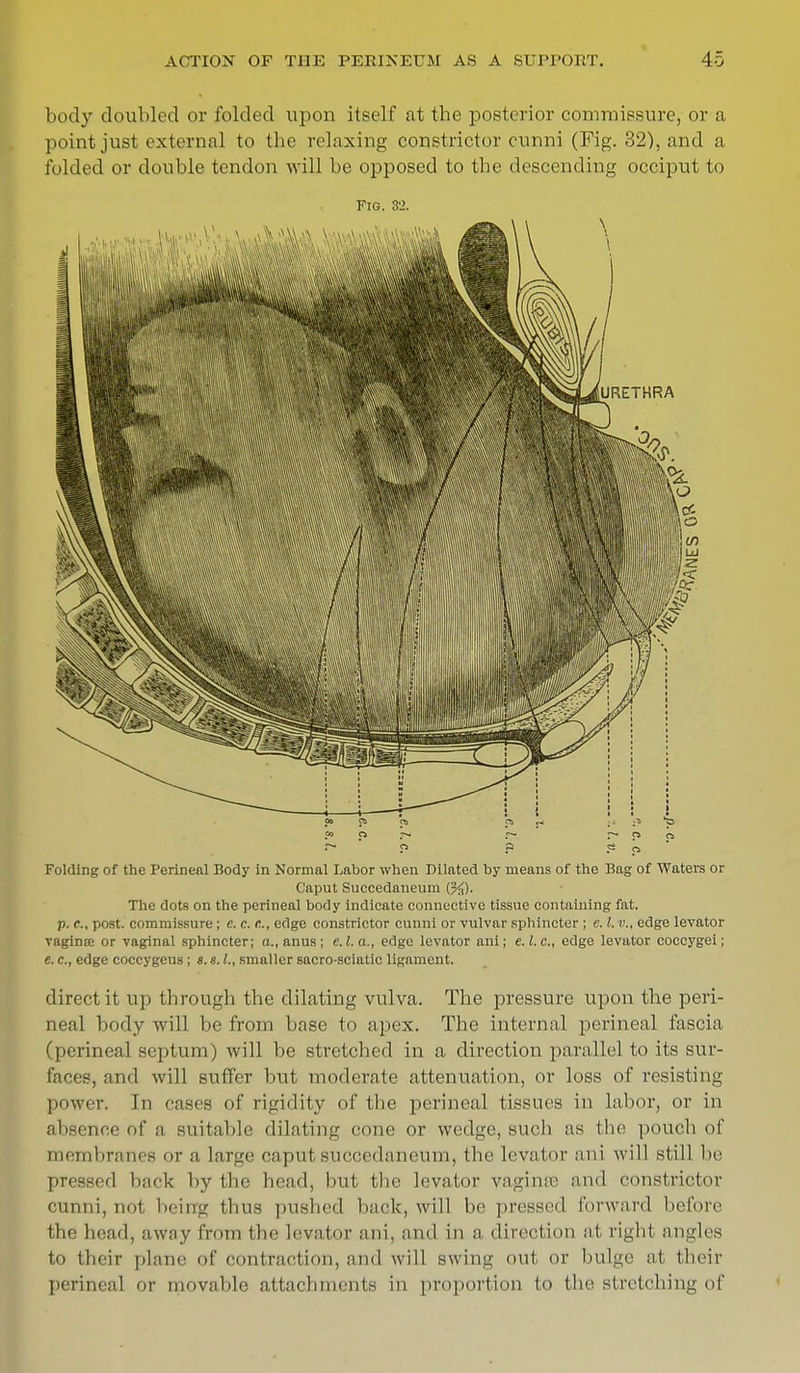 body doubled or folded upon itself at tbe posterior commissure, or a point just external to the relaxing constrictor cunni (Fig. 32), and a folded or double tendon will be opposed to the descending occiput to Fig. 32. •~ f5 P ? ra Folding of the Perineal Body in Normal Labor when Dilated by means of the Bag of Waters or Caput Suecedaneum (%). The dots on the perineal body indicate connective tissue containing fat. p. c, post, commissure; e. c. c., edge constrictor cunni or vulvar sphincter ; c. I. v., edge levator vagince or vaginal sphincter; a., anus; e.l.a., edge levator ani; e.l.c, edge levator coccygei; e. c, edge coceygcus ; s. s. L, smaller sacro-sciatic ligament. direct it up through the dilating vulva. The pressure upon the peri- neal body will be from base to apex. The internal perineal fascia (perineal septum) will be stretched in a direction parallel to its sur- faces, and will suffer but moderate attenuation, or loss of resisting power. In eases of rigidity of the perineal tissues in labor, or in absence of a suitable dilating cone or wedge, such as the pouch of membranes or a large caput suecedaneum, the levator aid will still he pressed back by the head, hut the levator vaginte and constrictor cunni, not being thus pushed back, will be pressed forward before the head, away from the levator aid, and in a. direction at right angles to their plane of contraction, and will swing out or bulge at their perineal or movable attachments in proportion to the stretching of