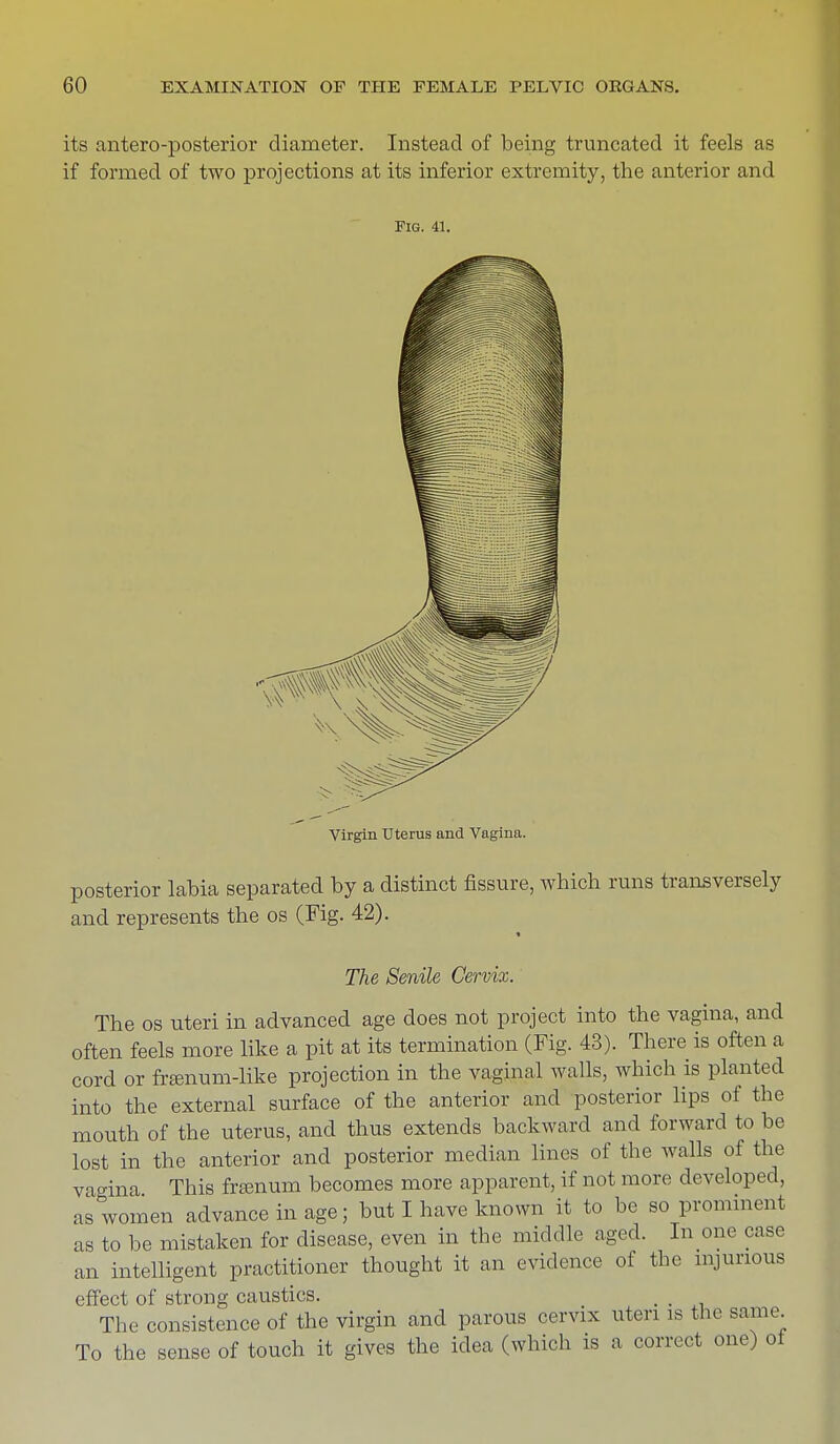 its anteroposterior diameter. Instead of being truncated it feels as if formed of two projections at its inferior extremity, the anterior and Fig. 41. Virgin Uterus and Vagina. posterior labia separated by a distinct fissure, which runs transversely and represents the os (Fig. 42). The Senile Cervix. The os uteri in advanced age does not project into the vagina, and often feels more like a pit at its termination (Fig. 43). There is often a cord or frasnum-like projection in the vaginal walls, which is planted into the external surface of the anterior and posterior lips of the mouth of the uterus, and thus extends backward and forward to be lost in the anterior and posterior median lines of the walls of the vagina This franum becomes more apparent, if not more developed, as women advance in age; but I have known it to be so prominent as to be mistaken for disease, even in the middle aged. In one case an intelligent practitioner thought it an evidence of the injurious effect of strong caustics. The consistence of the virgin and parous cervix uteri is the same To the sense of touch it gives the idea (which is a correct one) oi