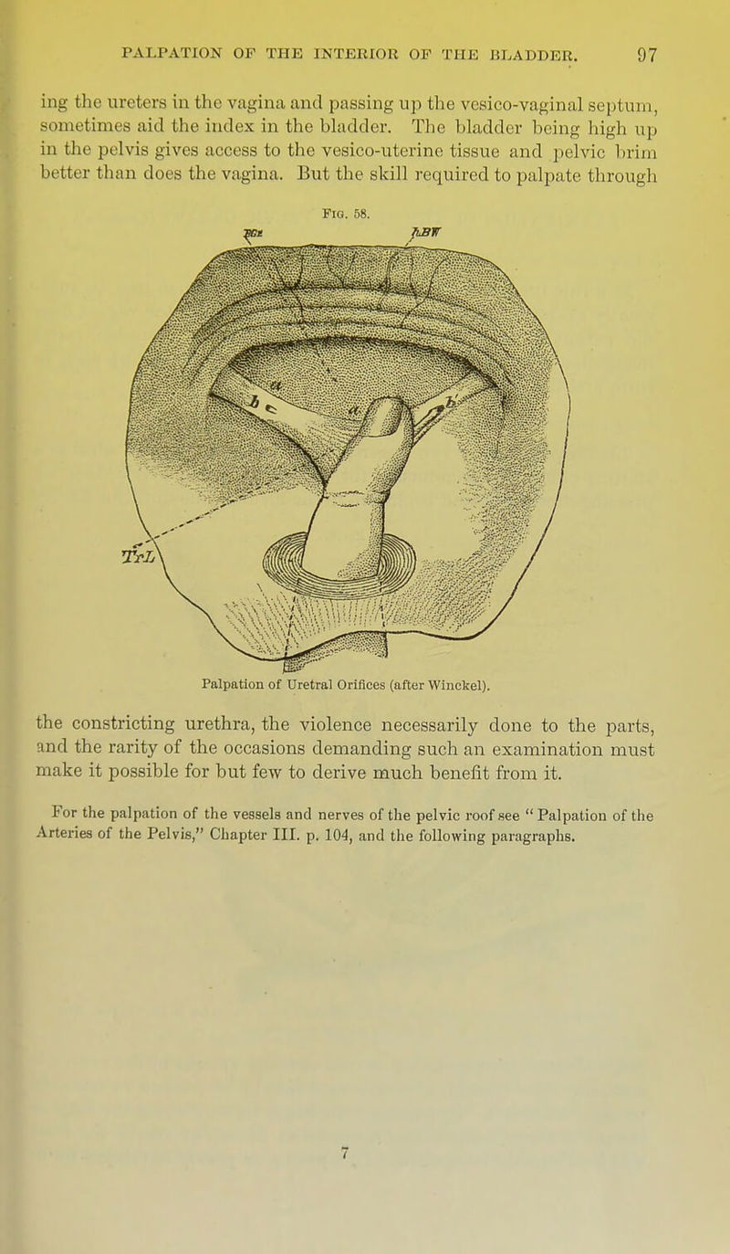 ing the ureters in the vagina and passing up the vesico-vaginal septum, sometimes aid the index in the bladder. The bladder being high up in the pelvis gives access to the vesicouterine tissue and pelvic brim better than does the vagina. But the skill required to palpate through Fig. 58. Palpation of Uretrai Orifices (after Winckel). the constricting urethra, the violence necessarily done to the parts, and the rarity of the occasions demanding such an examination must make it possible for but few to derive much benefit from it. For the palpation of the vessels and nerves of the pelvic roof see Palpation of the Arteries of the Pelvis, Chapter III. p. 104, and the following paragraphs.