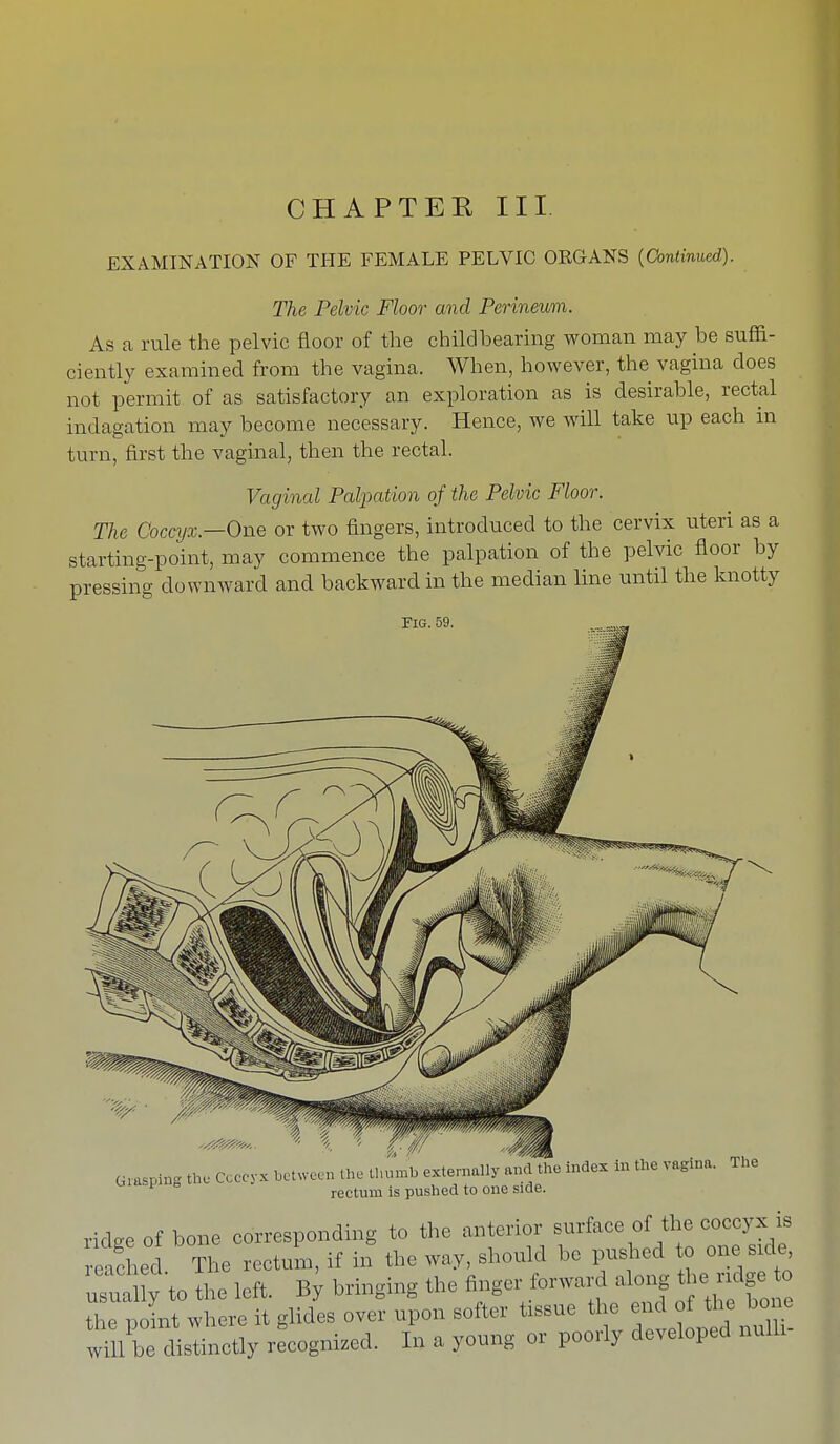 CHAPTEE III. EXAMINATION OF THE FEMALE PELVIC ORGANS (Continued). The Pelvic Floor and Perineum. As a rule the pelvic floor of the child hearing woman may he suffi- ciently examined from the vagina, When, however, the vagina does not permit of as satisfactory an exploration as is desirable, rectal indagation may become necessary. Hence, we will take up each in turn, first the vaginal, then the rectal. Vaginal Palpation of the Pelvic Floor. The Coccyx— One or two fingers, introduced to the cervix uteri as a starting-point, may commence the palpation of the pelvic floor by pressing downward and backward in the median line until the knotty Fig. 59. Grasping th. Coccyx between the thumb externally and the index in the vagina. The 1 ° rectum is pushed to one side. ridge of bone corresponding to the anterior surface of the coccyx is reached The rectum, if in the way, should be pushed to one side rXtO the left. By bringing the anger forwar the point where it glides over upon softer tissue the end of the bone wZe distinctly recognized. In a young or poorly developed null,