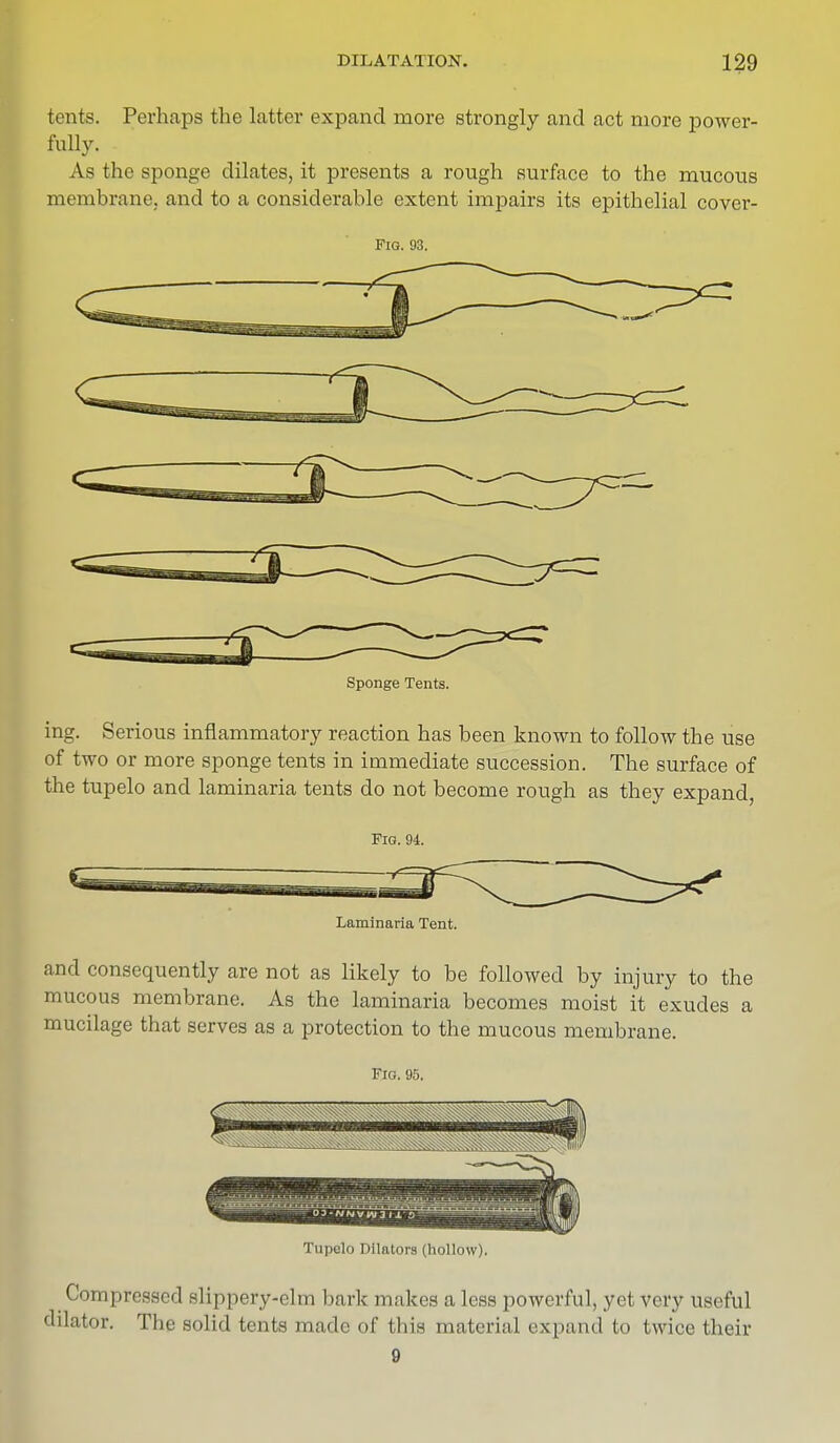 tents. Perhaps the latter expand more strongly and act more power- fully. As the sponge dilates, it presents a rough surface to the mucous membrane, and to a considerable extent impairs its epithelial cover- Fig. 93. Sponge Tents. ing. Serious inflammatory reaction has been known to follow the use of two or more sponge tents in immediate succession. The surface of the tupelo and laminaria tents do not become rough as they expand, Fig. 94. Laminaria Tent. and consequently are not as likely to be followed by injury to the mucous membrane. As the laminaria becomes moist it exudes a mucilage that serves as a protection to the mucous membrane. Fig. 95. Tupelo Dilators (hollow). Compressed slippery-elm bark makes a less powerful, yel very useful dilator. The solid tents made of this material expand to twice their 9