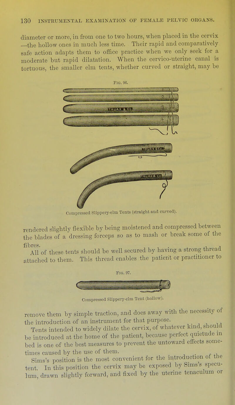 diameter or more, in from one to two hours, when placed in the cervix the hollow ones in much less time. Their rapid and comparatively safe action adapts them to office practice when we only seek for a moderate hut rapid dilatation. When the cervico-uterine canal is tortuous, the smaller elm tents, whether curved or straight, may be Fig. 96. Compressed Slippery-elm Tents (straight and curved). rendered slightly flexible by being moistened and compressed between the blades of a dressing forceps so as to mash or break some of the All'of these tents should be well secured by having a strong thread attached to them. This thread enables the patient or practitioner to Fig. 97. Compressed Slippery-elm Tent (hollow). remove them by simple traction, and does away with the necessity of the introduction of an instrument for that purpose. Tents intended to widely dilate the cervix, of whatever kind, should be introduced at the home of the patient, because perfect quietude in bed is one of the best measures to prevent the untoward effects some- times caused by the use of them. Sims's position is the most convenient for the introduction of the tent. In this position the cervix may be exposed by Sims s specu- lum, drawn slightly forward, and fixed by the uterine tenaculum or