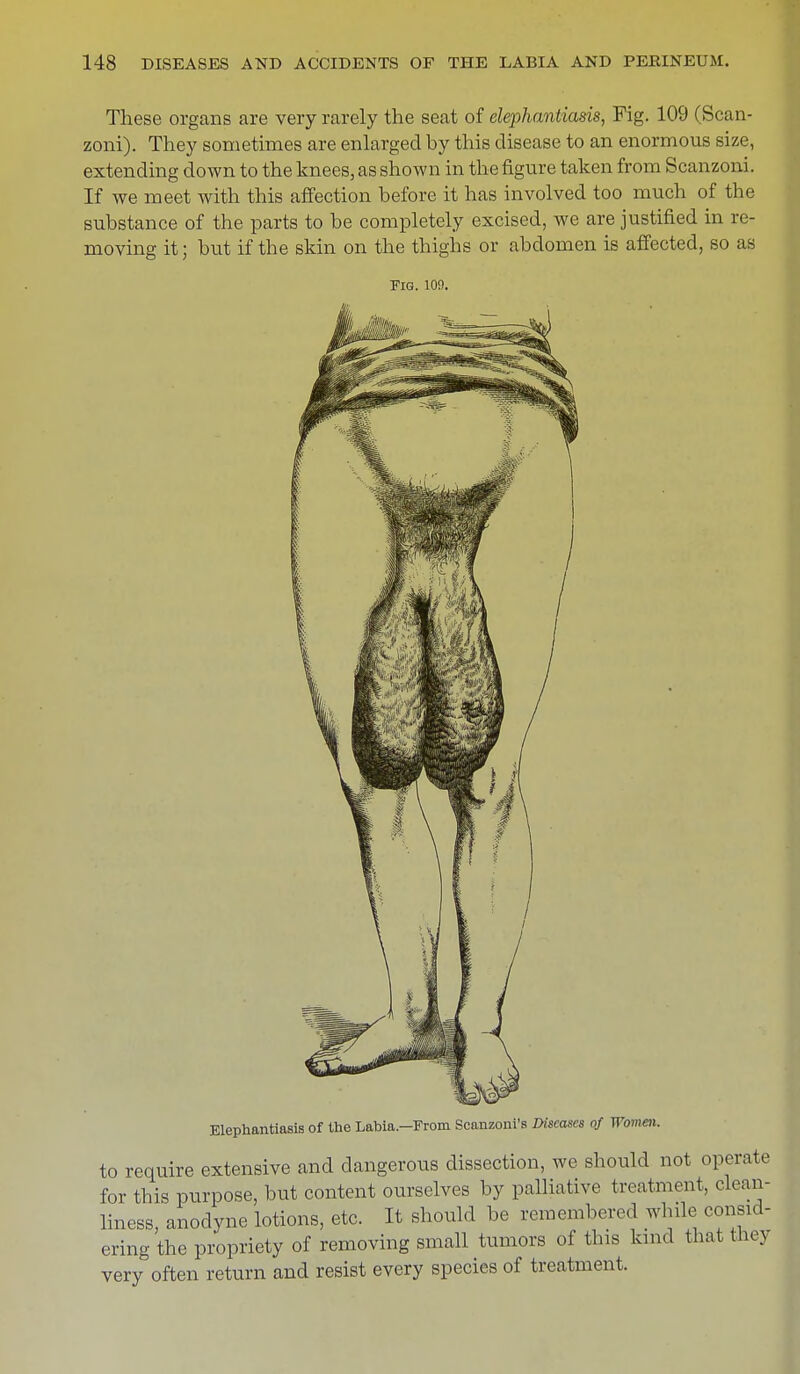 These organs are very rarely the seat of elephantiasis, Fig. 109 (Scan- zoni). They sometimes are enlarged by this disease to an enormous size, extending down to the knees, as shown in the figure taken from Scanzoni. If we meet with this affection before it has involved too much of the substance of the parts to be completely excised, we are justified in re- moving it; but if the skin on the thighs or abdomen is affected, so as Fig. 100. Elephantiasis of the Labia.—From Scanzoni's Diseases of Women. to require extensive and dangerous dissection, we should not operate for this purpose, but content ourselves by palliative treatment, clean- liness, anodyne lotions, etc. It should be remembered while consid- ering the propriety of removing small tumors of this kind that they very often return and resist every species of treatment.