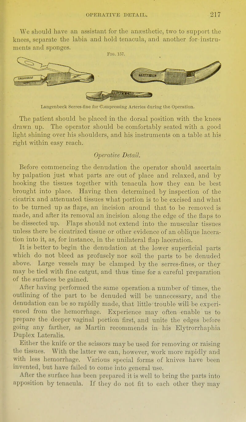 We should have an assistant for the anaesthetic, two to support the knees, separate the labia and hold tenacula, and another for-instru- ments and sponges. Fig. 157. Langenbeck Serres-fine for Compressing Arteries during the Operation. The patient should he placed in the dorsal position with the knees drawn up. The operator should he comfortably seated with a good light shining over his shoulders, and his instruments on a table at his right within easy reach. Operative Detail. Before commencing the denudation the operator should ascertain by palpation just what parts are out of place and relaxed, and by hooking the tissues together with tenacula how they can be best brought into place. Having then determined by inspection of the cicatrix and attenuated tissues what portion is to be excised and what to be turned up as flaps, an incision around that to be removed is made, and after its removal an incision along the edge of the flaps to be dissected up. Flaps should not extend into the muscular tissues unless there be cicatrized tissue or other evidence of an oblique lacera- tion into it, as, for instance, in the unilateral flap laceration. It is better to begin the denudation at the lower superficial parts which do not bleed as profusely nor soil the parts to be denuded above. Large vessels may be clamped by the serres-fines, or they may be tied with fine catgut, and thus time for a careful preparation of the surfaces be gained. After having performed the same operation a number of times, the outlining of the part to be denuded will be unnecessary, and the denudation can be so rapidly made, that little' trouble will be experi- enced from the hemorrhage. Experience may often enable us to prepare the deeper vaginal portion first, and unite the edges before going any farther, as Martin recommends in his Elytrorrhaphia Duplex Lateralis. Either the knife or the scissors maybe used for removing or raising the tissues. With the latter we can, however, work more rapidly and with less hemorrhage. Various special forms of knives have been invented, but have failed to come into general use. After the surface has been prepared it is well to bring the parts into apposition by tenacula. If they do not fit to each other they may
